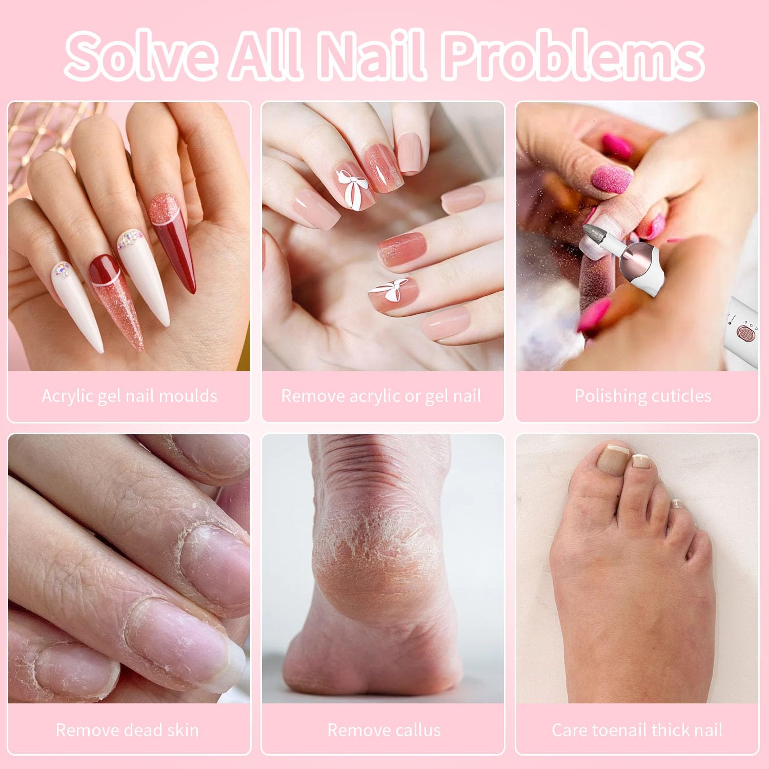 Collage mit Nagelproblemen und Lösungen: Acryl, Gelentfernung, Nagelhaut, Schwielen und dicke Nägel.