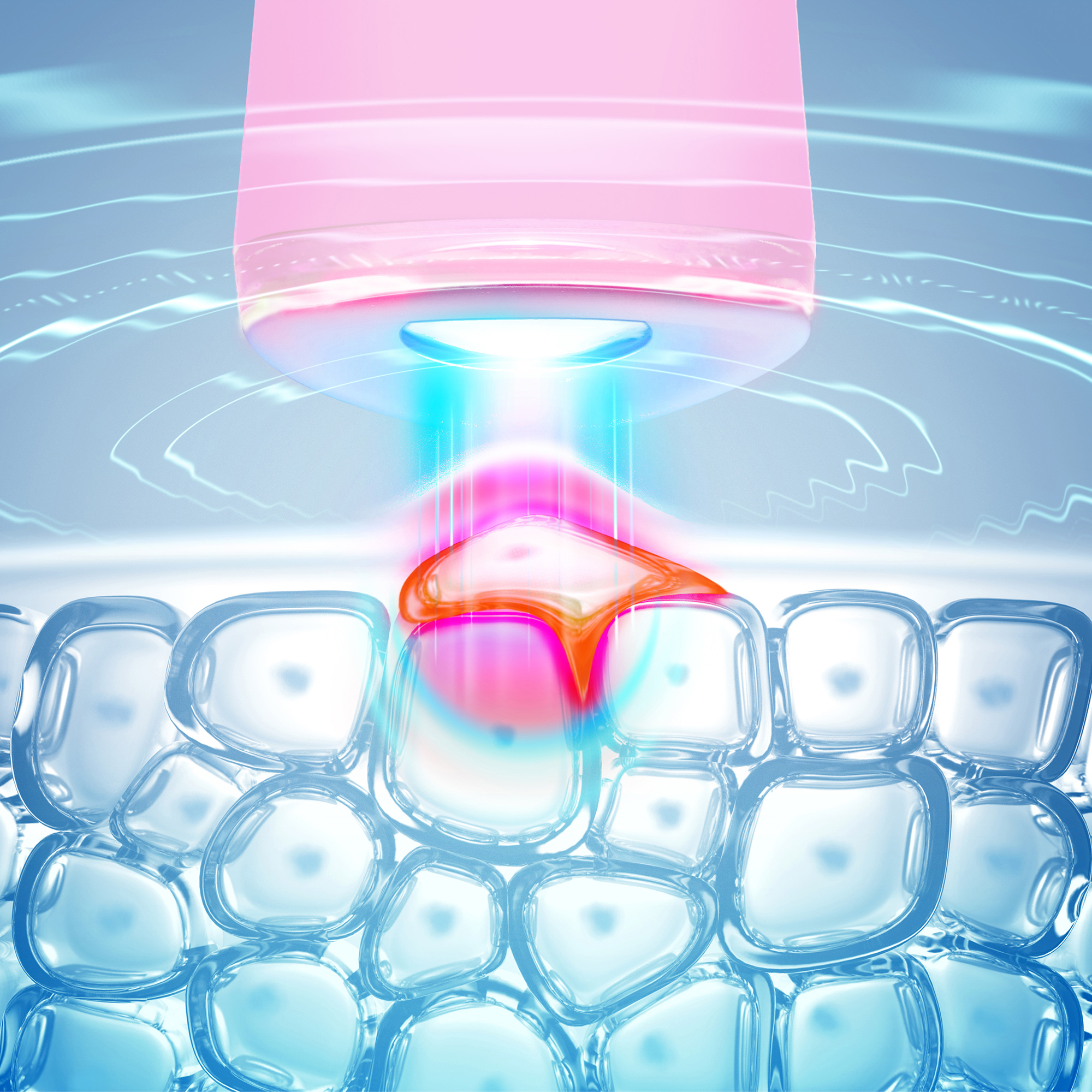 Close-up of skin cells with a laser beam targeting a red spot. Blue glow around.