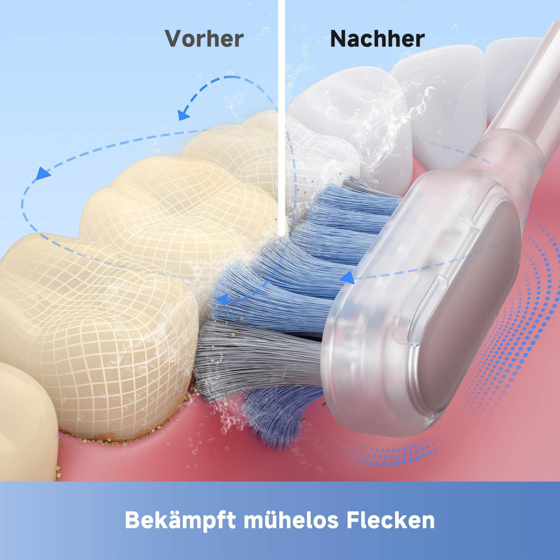 Bild zeigt Zähne vor und nach dem Putzen mit einer Zahnbürste. Text auf Deutsch.