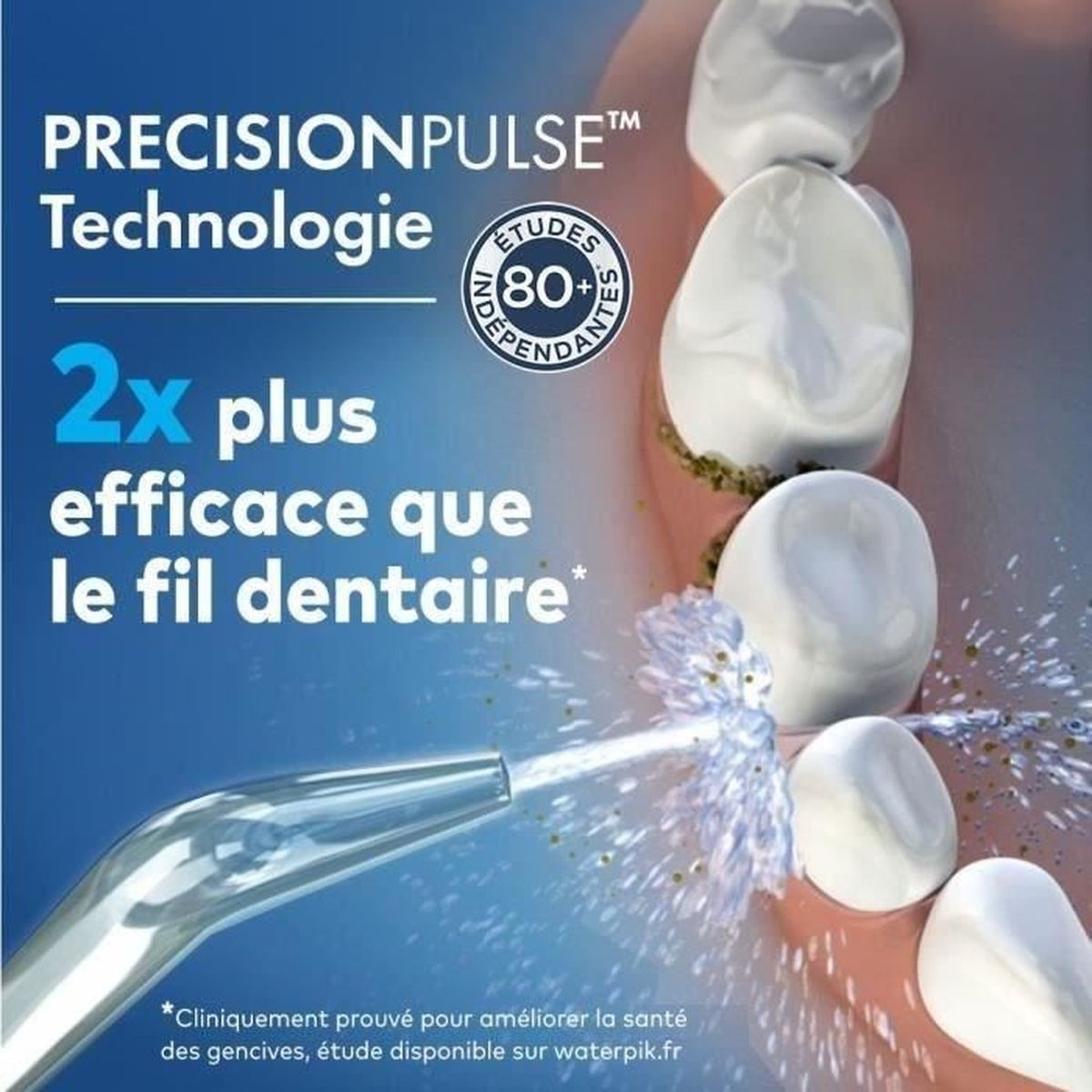 Primo piano dei denti con acqua spruzzata da un Waterpik, evidenziando i benefici per la salute dentale.
