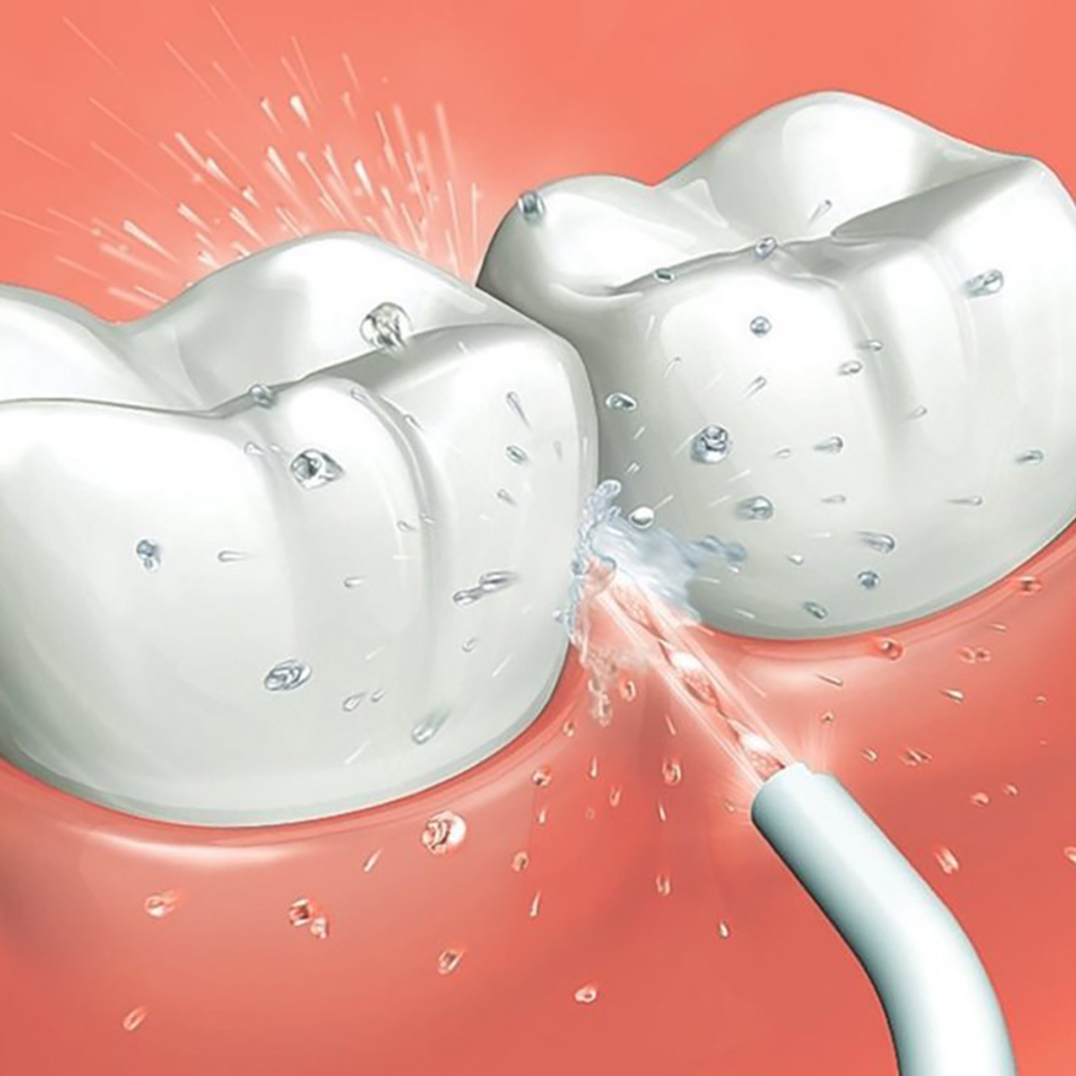 Primer plano de dos dientes blancos siendo limpiados por un irrigador oral con chorros de agua.