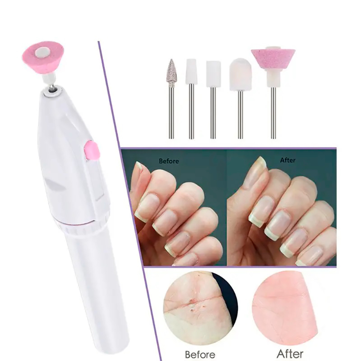 Dispositivo blanco para el cuidado de las uñas con cabezales intercambiables, imágenes de comparación antes/después de las uñas y un enfoque en un dedo del pie.