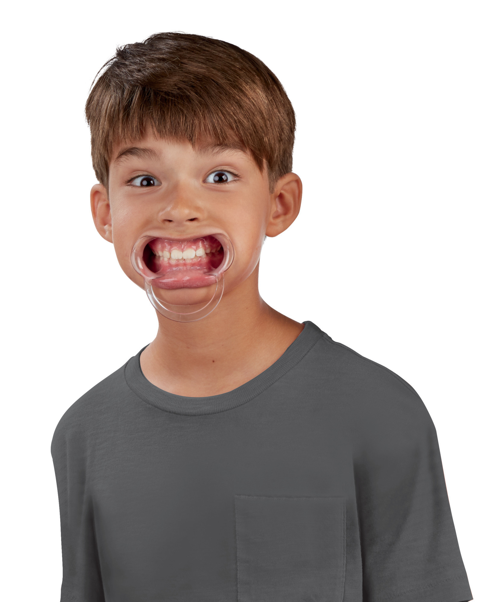 Un ragazzo con un retrattore per la bocca, che fa una faccia sorpresa.