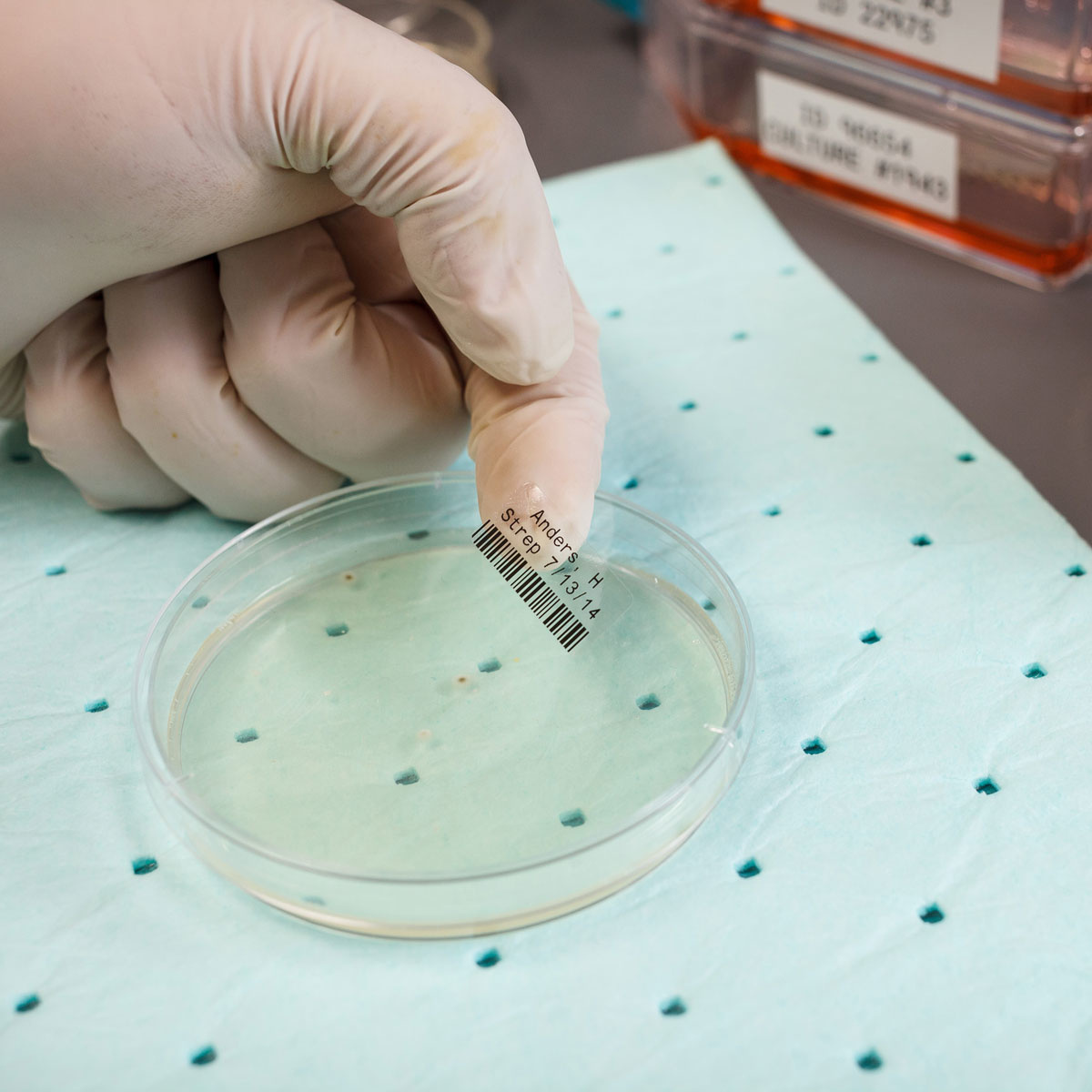 Una mano guantata tiene una capsula di Petri con un'etichetta. La capsula ha un liquido trasparente e punti.