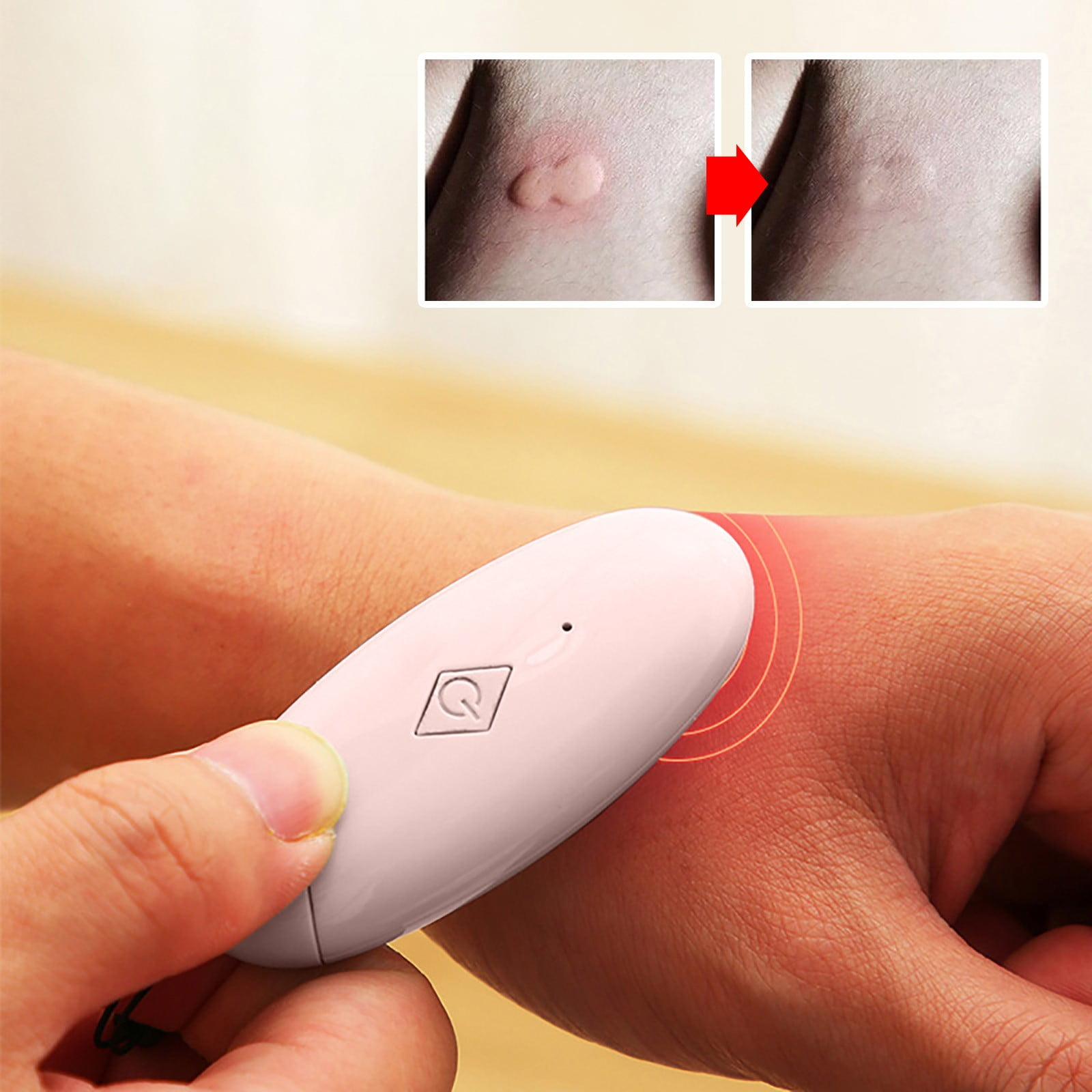 Ein Gerät wird am Handgelenk einer Person verwendet. Das Gerät ist rosa und oval.