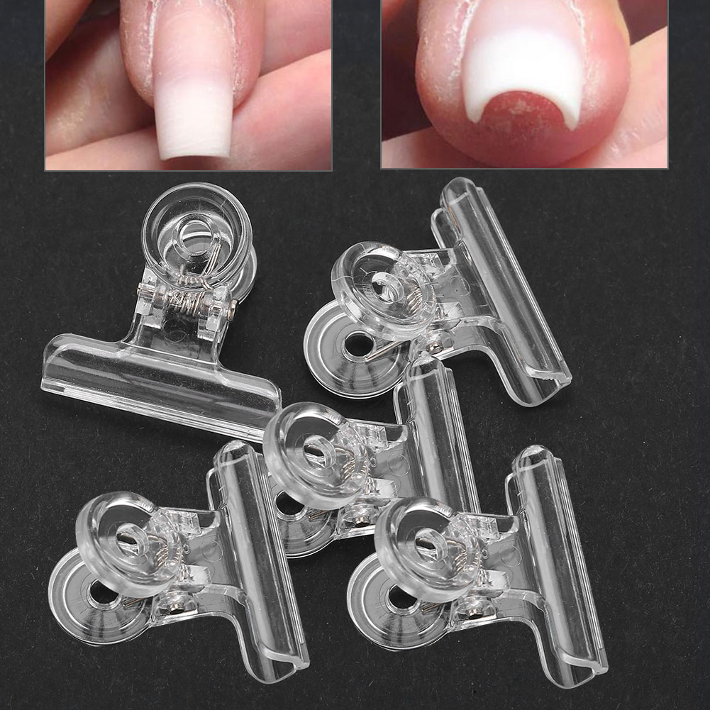 Fünf transparente Nagelkunst-Clips mit zwei Nagelkunst-Beispielen. Clips mit gebogener Oberseite und Federmechanismus.