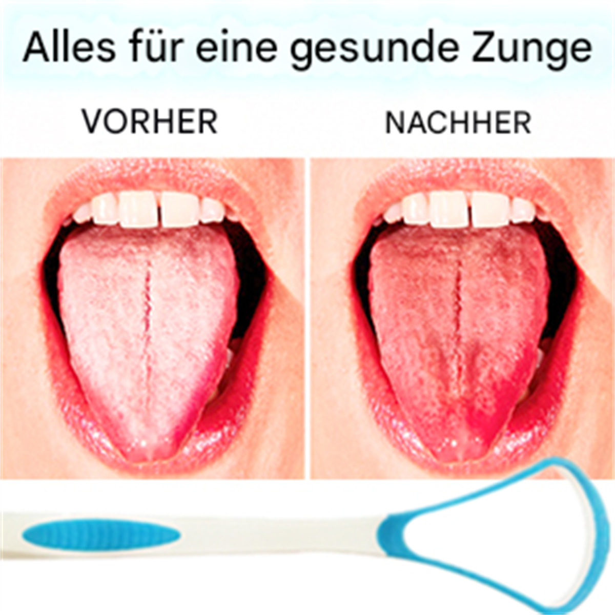 Bild, das eine Zunge vor und nach dem Reinigen vergleicht. Ein Zungenschaber befindet sich am unteren Rand.