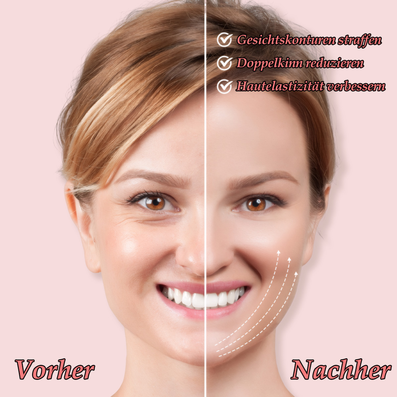 Ein Vorher-Nachher-Bild des Gesichts einer Frau, das verbesserte Hautelastizität und reduzierte Falten zeigt.