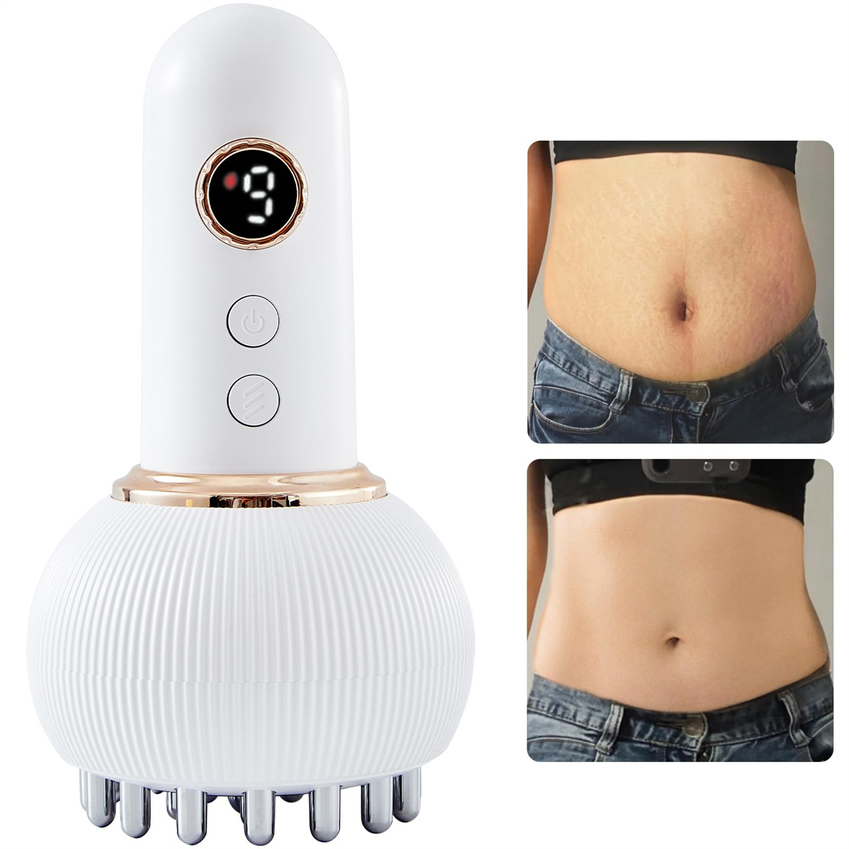 Weißes Gerät links, Bauch vorher und nachher rechts.