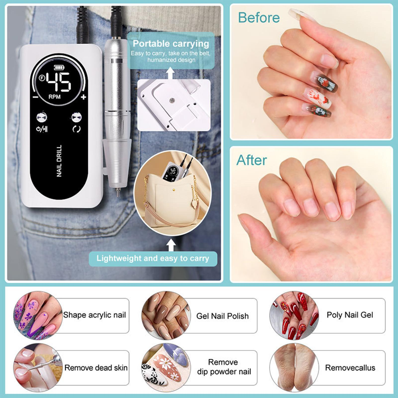 Eine rosa Nagelfräse mit Zubehör und Vorher-Nachher-Beispiele für Nagelbehandlungen.