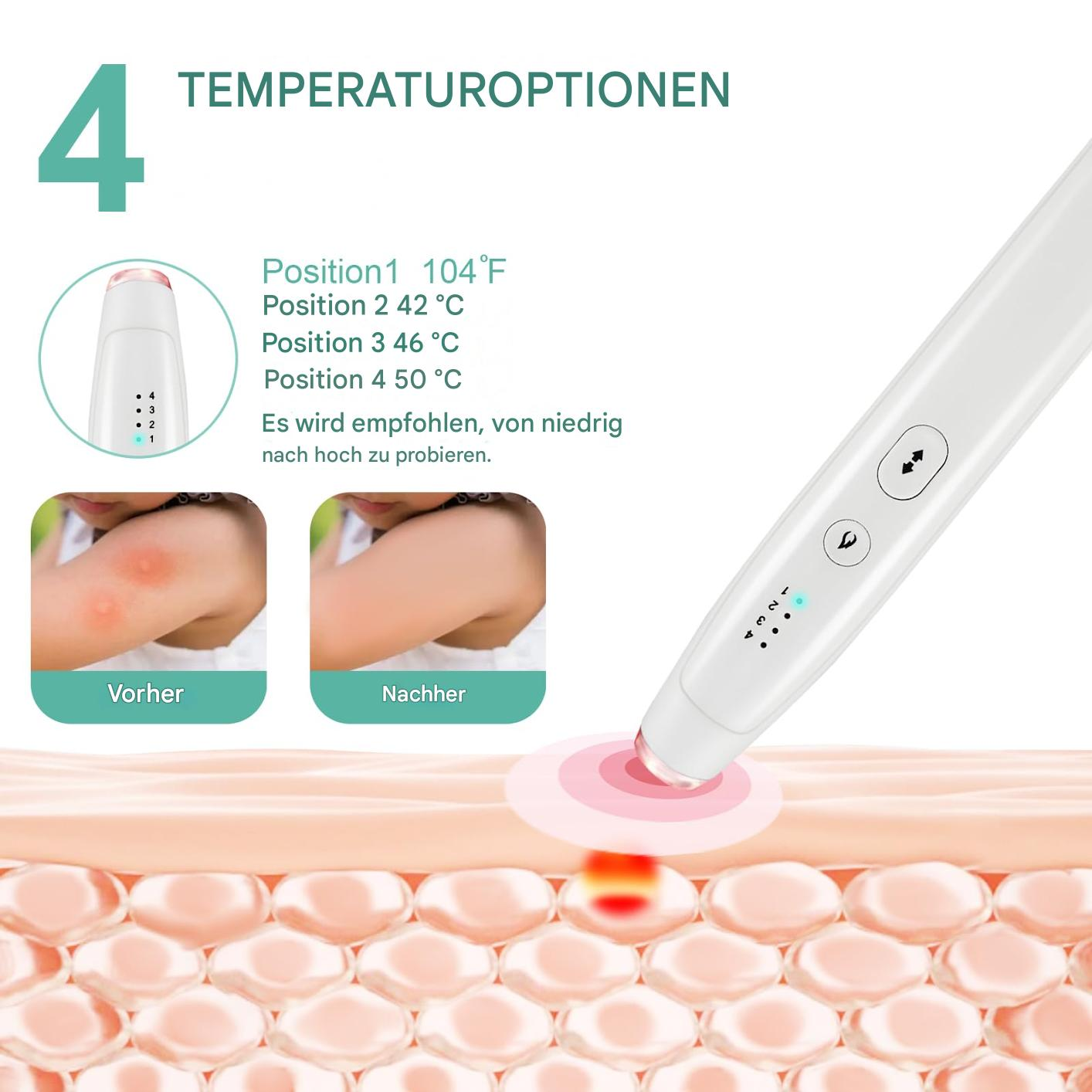 Weißes stiftförmiges Gerät mit Temperaturoptionen. Zeigt Vorher- und Nachher-Bilder eines roten Hautflecks, verwendet am Arm.