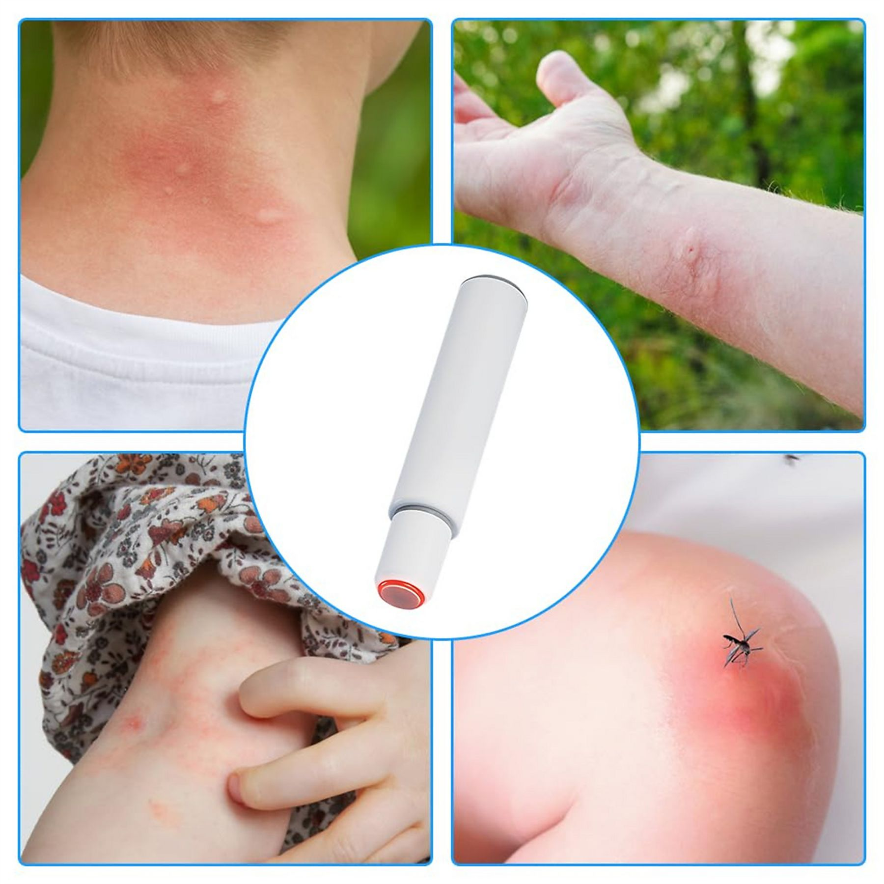 Das Bild zeigt Hautreaktionen: Hals, Arm und Bein mit Stichen. Ein weißes Gerät in der Mitte. Eine Mücke landet auf einem Biss.