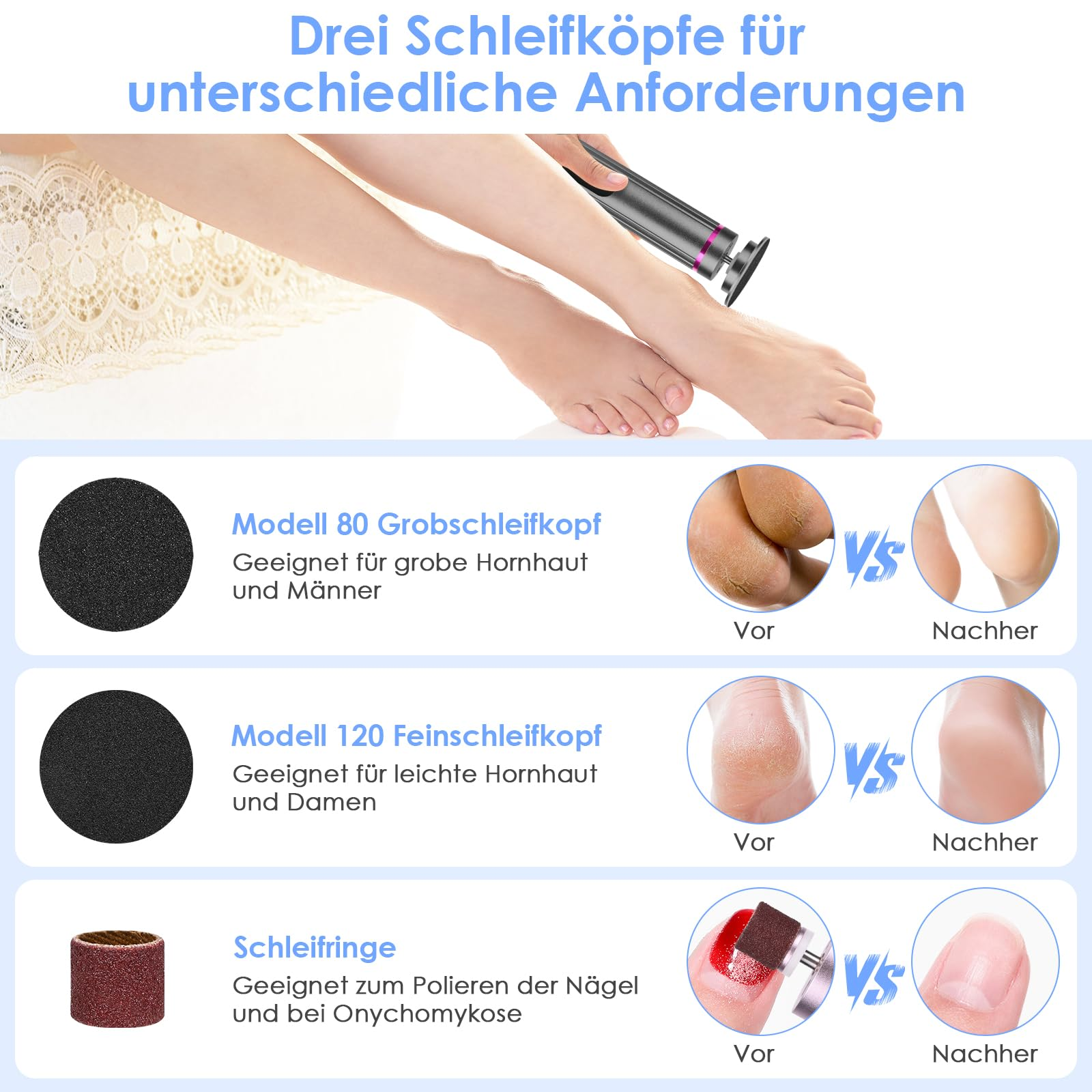 Das Bild zeigt ein Fußpflegegerät mit drei verschiedenen Schleifköpfen sowie Vorher-Nachher-Bilder.
