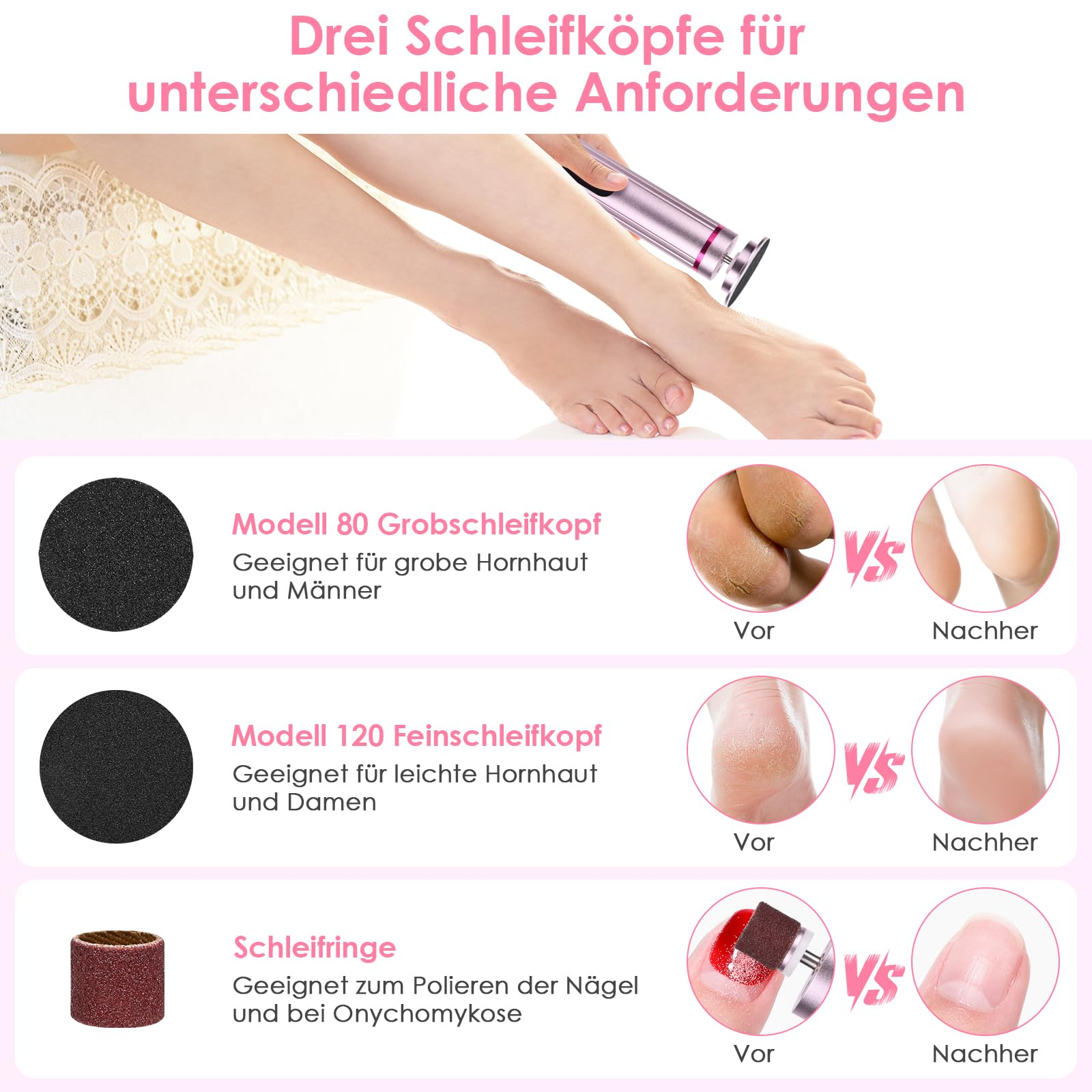 Füße mit Fußpflege-Werkzeug und Vergleiche von Vorher-Nachher-Anwendung für verschiedene Fußprobleme.