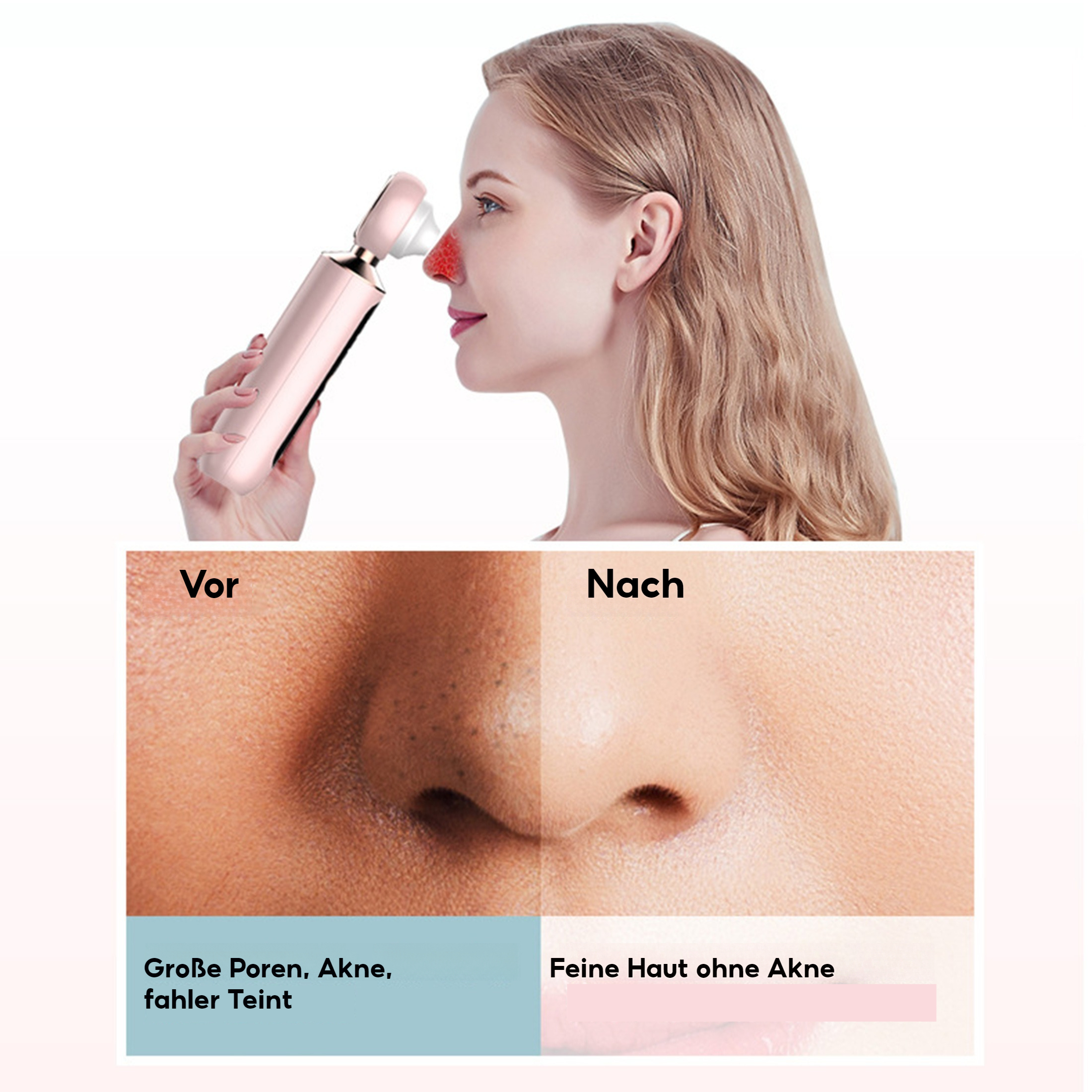 Eine Frau benutzt ein rosa Gerät auf ihrer Nase. Unten zeigen Bilder Haut vor und nach der Behandlung.
