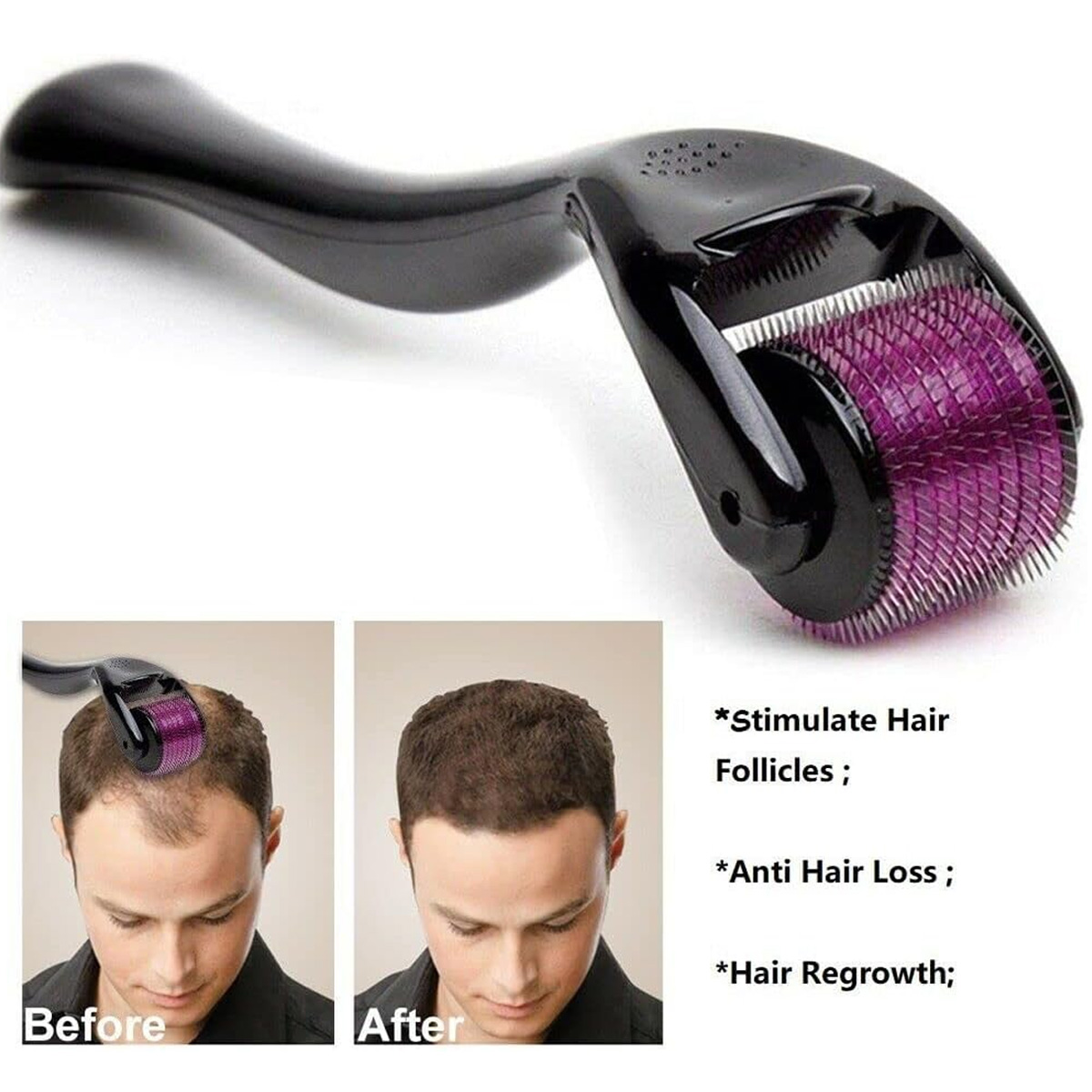 Schwarzer Derma-Roller mit lila Rolle. Bilder zeigen Vorher-Nachher-Haarwuchs.