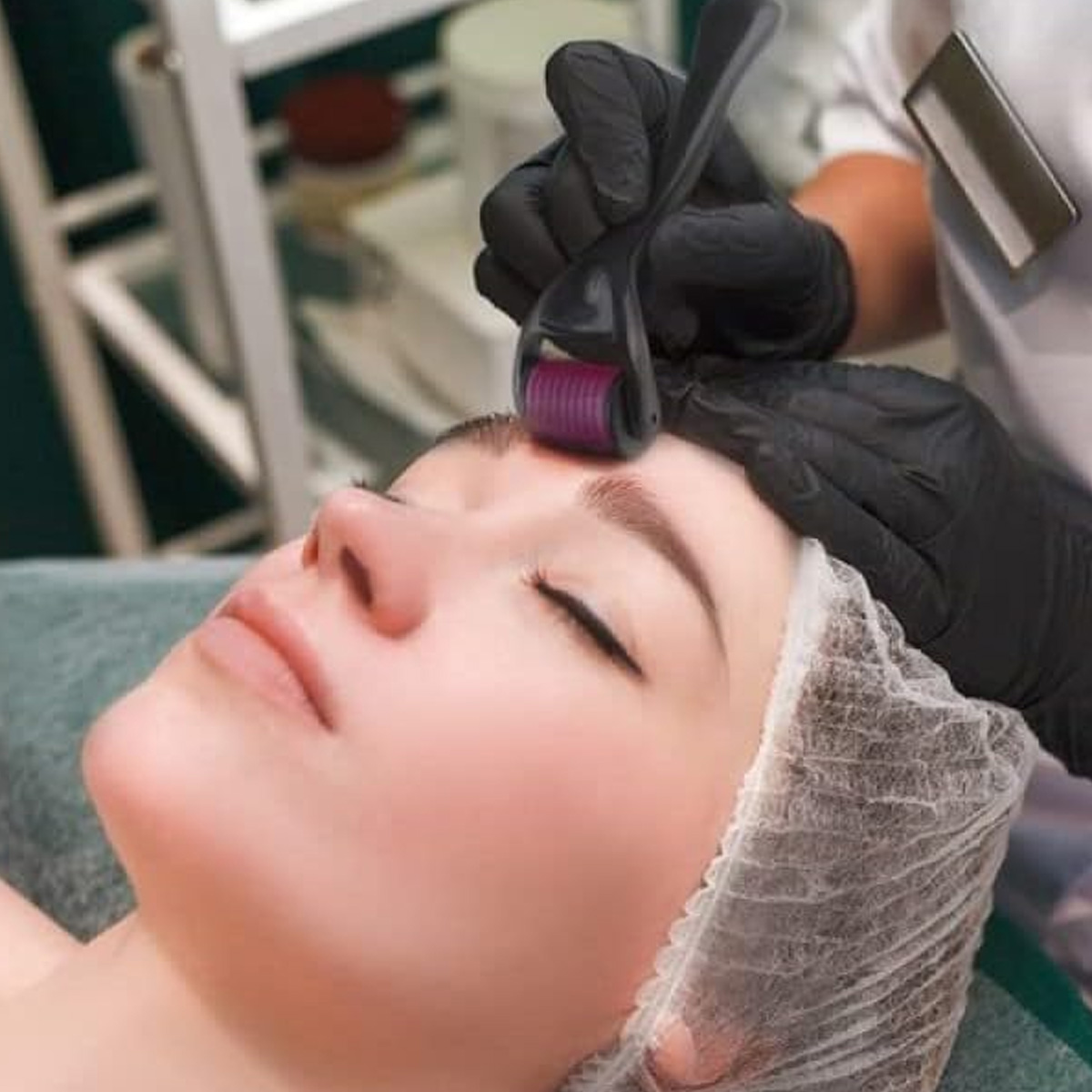 Das Gesicht einer Frau wird mit einem Derma-Roller behandelt. Ein Profi benutzt ihn.