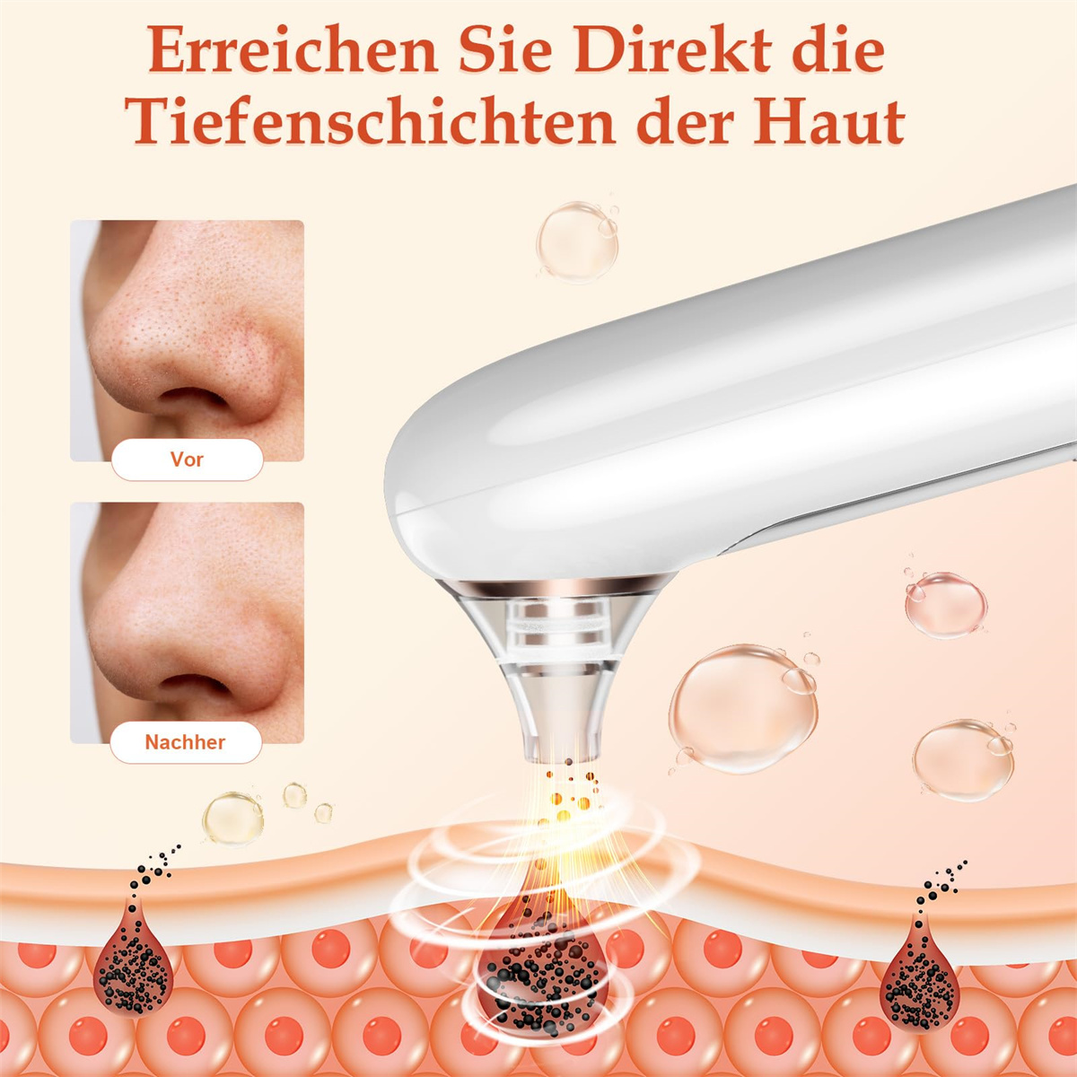 Diagramm eines Hautpflegegeräts, das Vorher- und Nachher-Bilder von Mitessern auf einer Nase zeigt.
