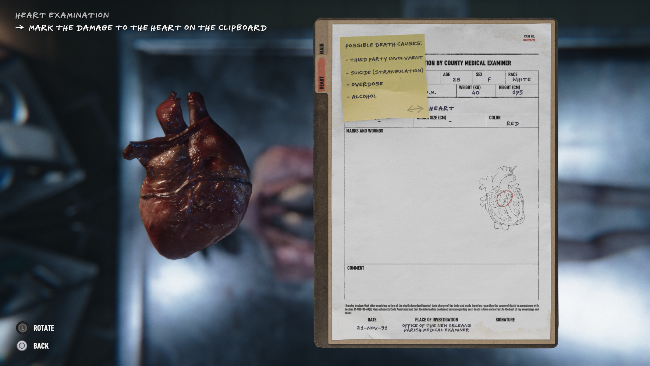 Un corazón y un documento médico con notas sobre posibles causas de muerte.