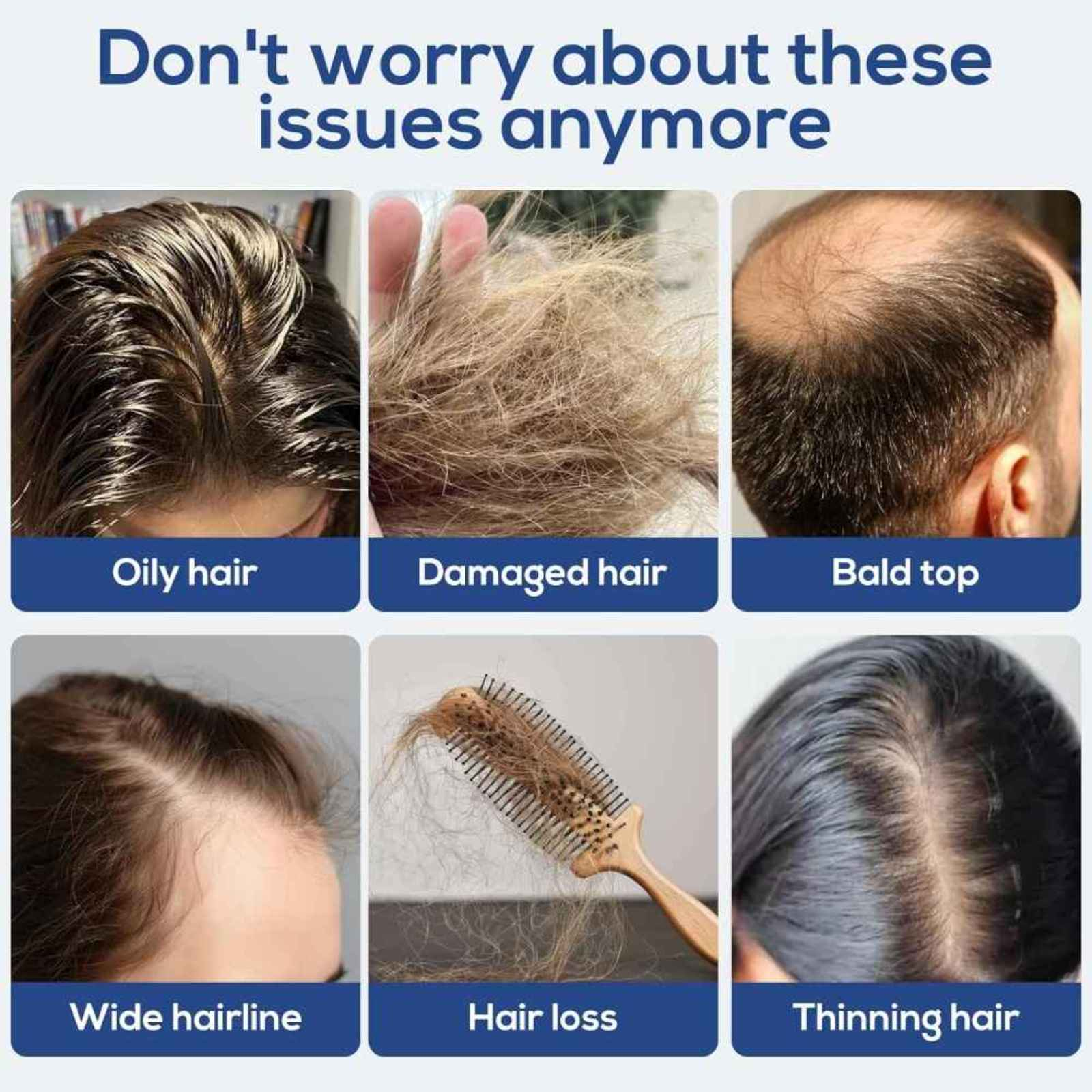 Das Bild zeigt sechs Haarprobleme: fettig, geschädigt, kahl, breiter Haaransatz, Haarausfall und dünner werdendes Haar. Der Text lautet: „Mach dir keine Sorgen mehr um diese Probleme“.