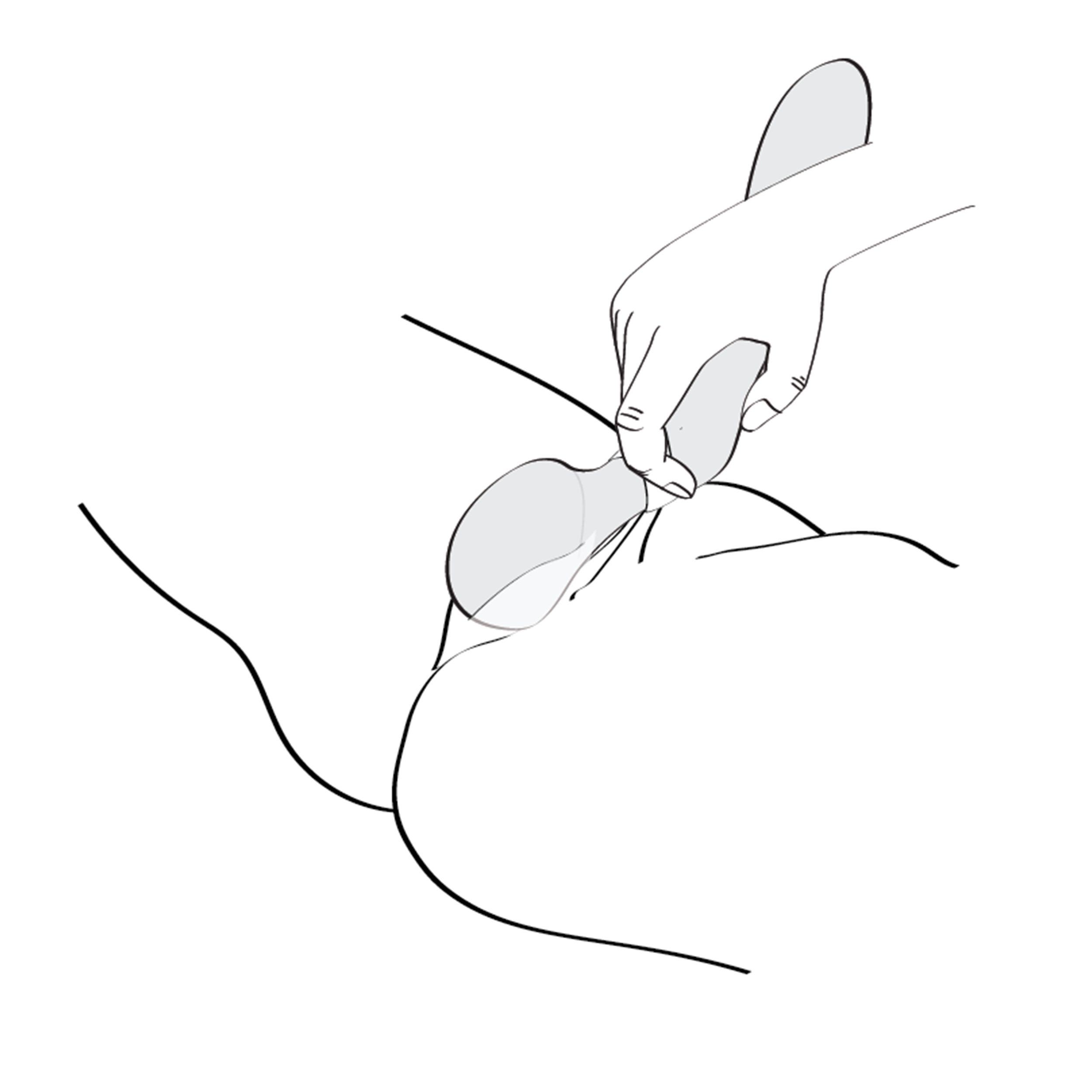 Dibujo lineal muestra una mano usando una herramienta en un cuerpo. La herramienta se inserta en el cuerpo.