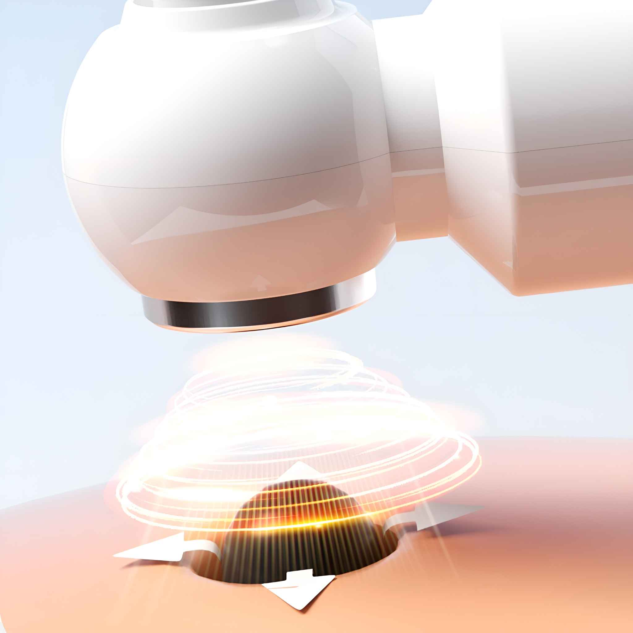 Ein weißes Gerät sendet Energie auf die Haut, mit einem dunklen Loch in der Haut. Helle Lichtstrahlen umgeben den Hautbereich.