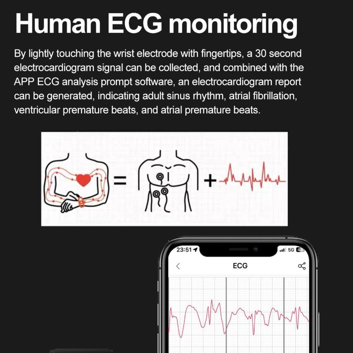 Das Bild zeigt das Konzept der EKG-Überwachung. Es zeigt ein Diagramm eines Herzens, Elektroden und ein Telefon, das ein EKG-Diagramm anzeigt.