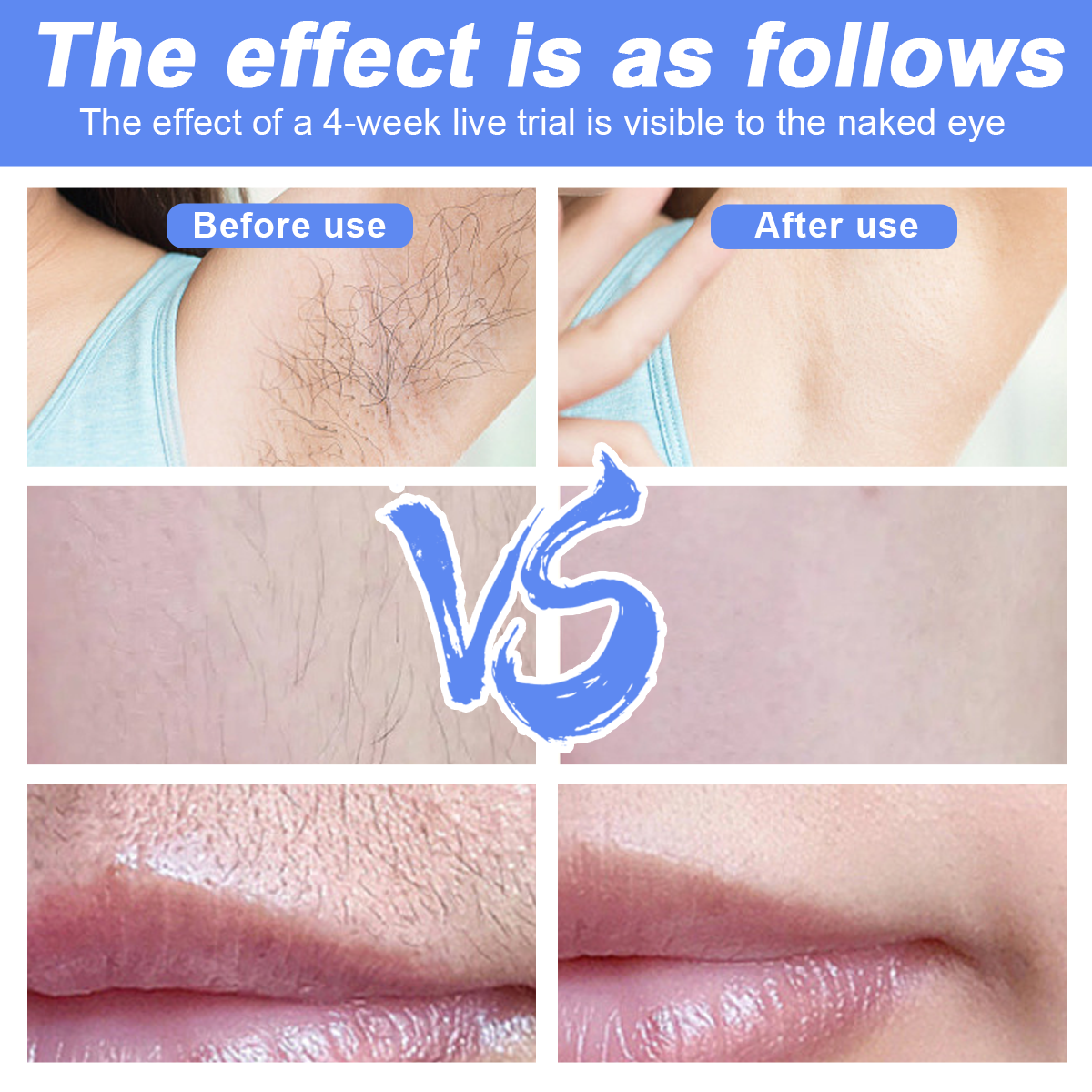 Das Bild zeigt Vergleiche: Vorher, Achseln mit Haaren; Nachher, glatte Achseln. Ähnliche Vergleiche für Bein- und Lippenbereiche.