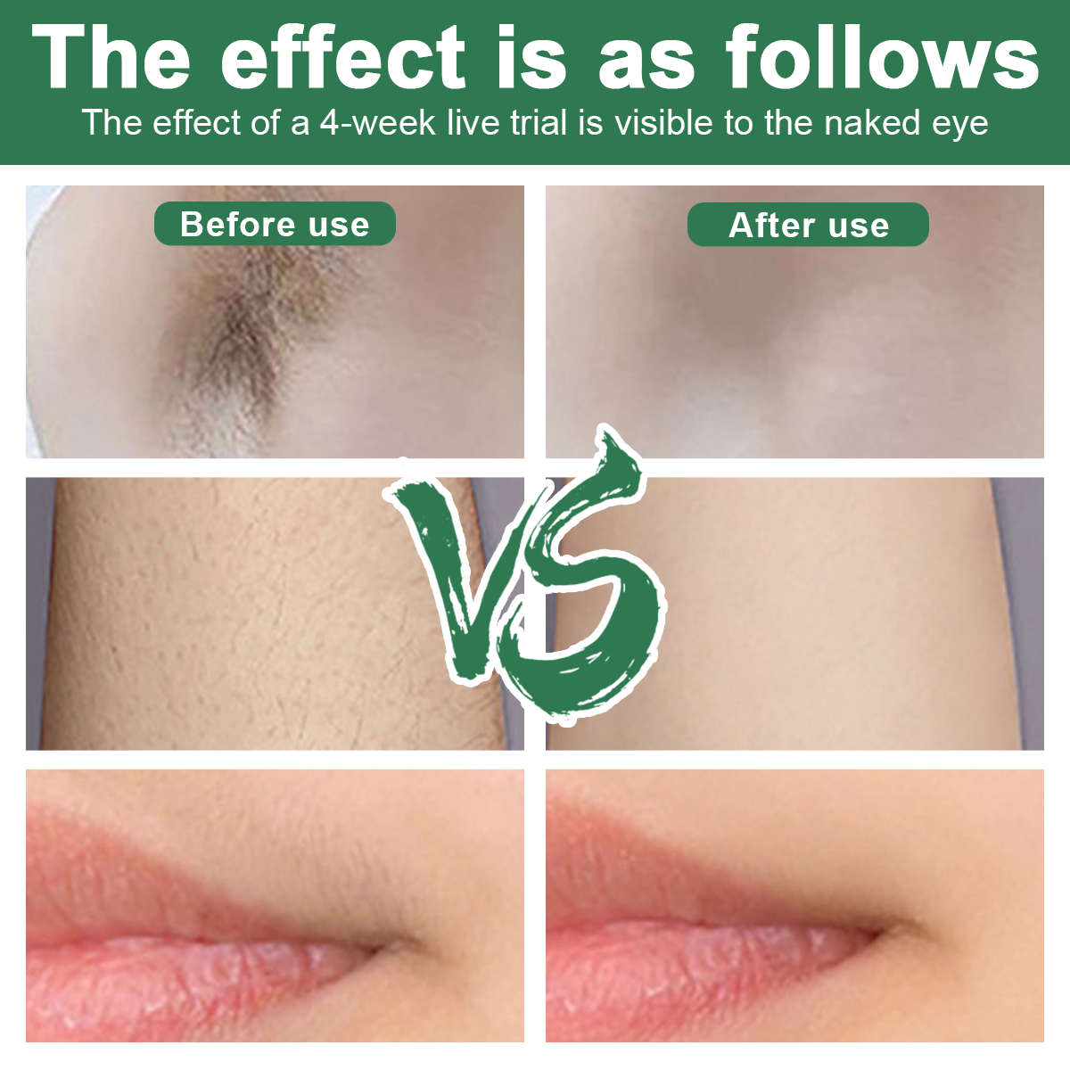 Vergleichsbild. Oben: Vorher/Nachher Achselhaarentfernung. Unten: Vorher/Nachher Lippenpflege. Mitte: Grünes 'VS'-Symbol.