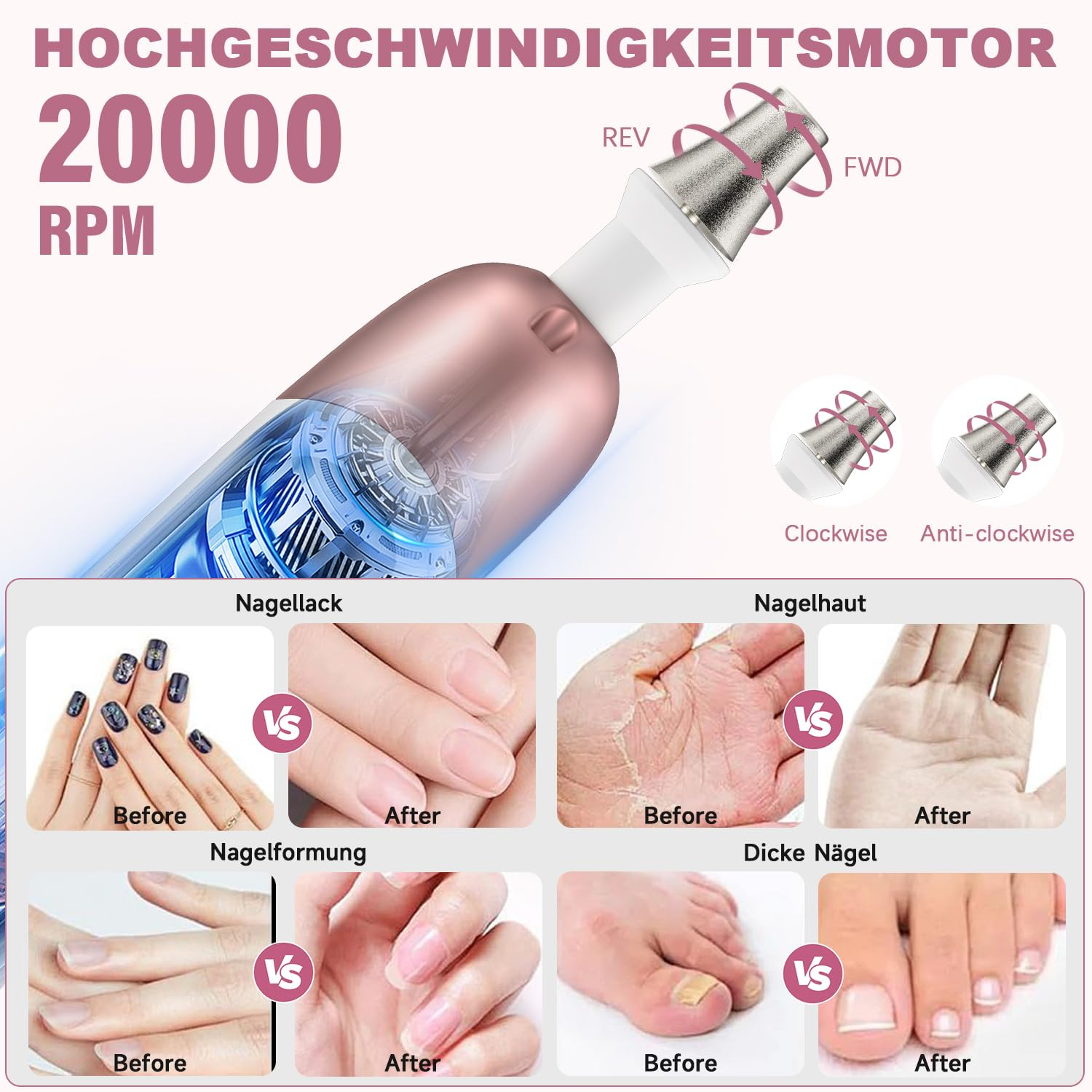 Das Bild zeigt ein Nagelpflegegerät mit Beschriftungen und Vergleichen: Nagellack, Nagelformung, Nagelhaut, Dicke Nägel, Vorher/Nachher-Bilder.