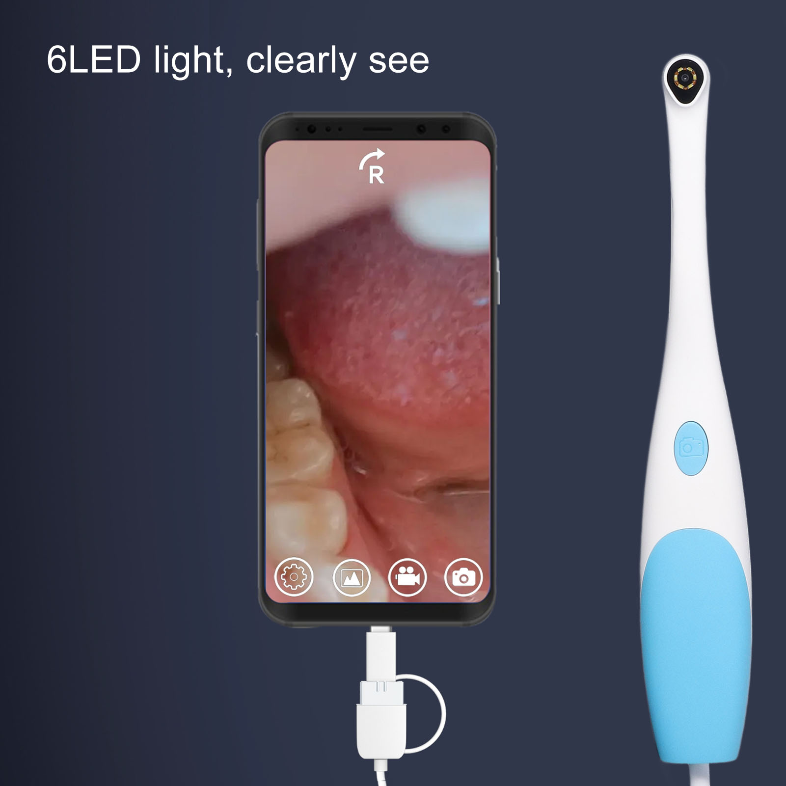 Endoskop mit Smartphone-Bildschirm, der das Innere eines Mundes zeigt. Das Endoskop ist weiß und blau.