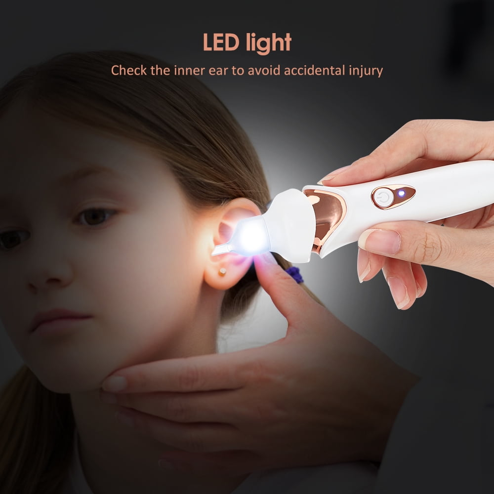 Ein Kinderohr wird mit einem LED-Otoskop untersucht. Das Werkzeug wird von einer Hand gehalten, das Ohr leuchtet und das Kind schaut zu.