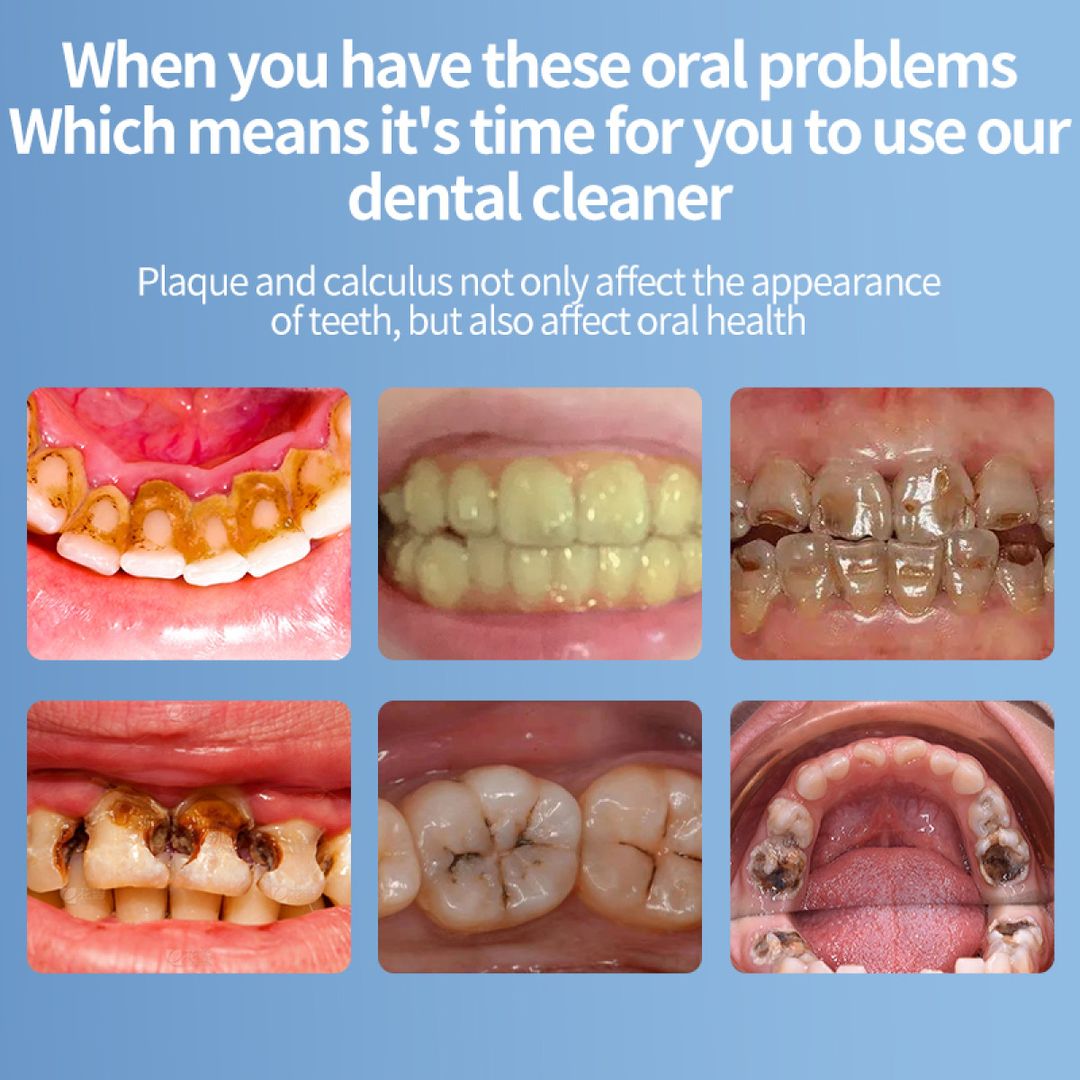 Image shows close-ups of teeth with plaque and cavities, illustrating dental problems. Text highlights use of a dental cleaner.