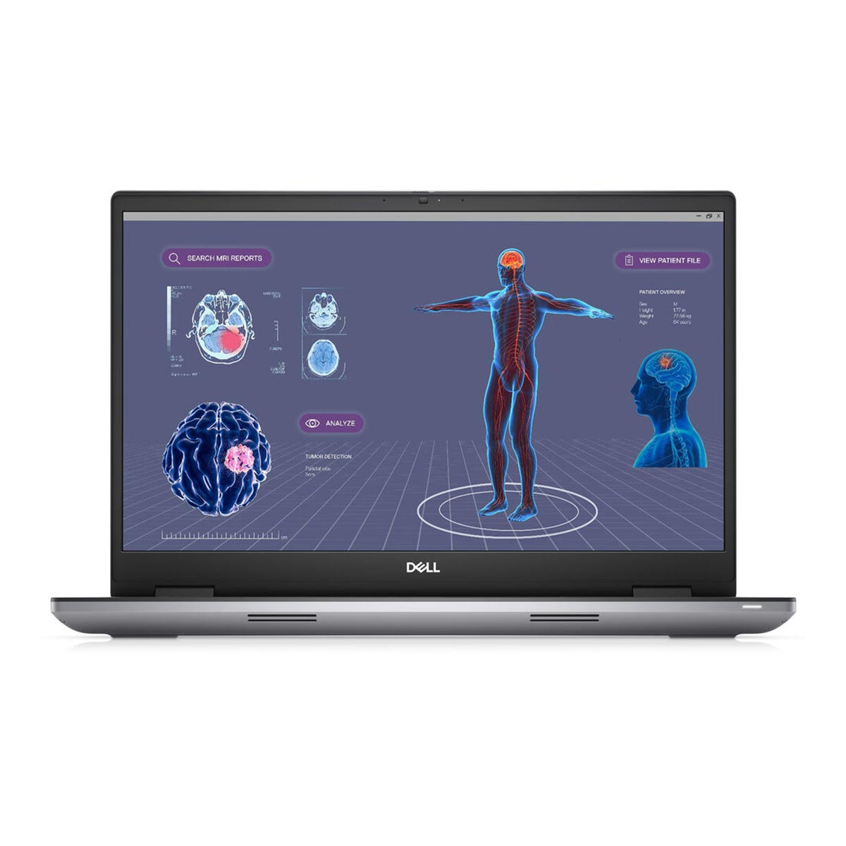 Ekran laptopa pokazujący skany medyczne i model ludzkiego ciała. Analiza wykrywania guzów. Logo Dell.