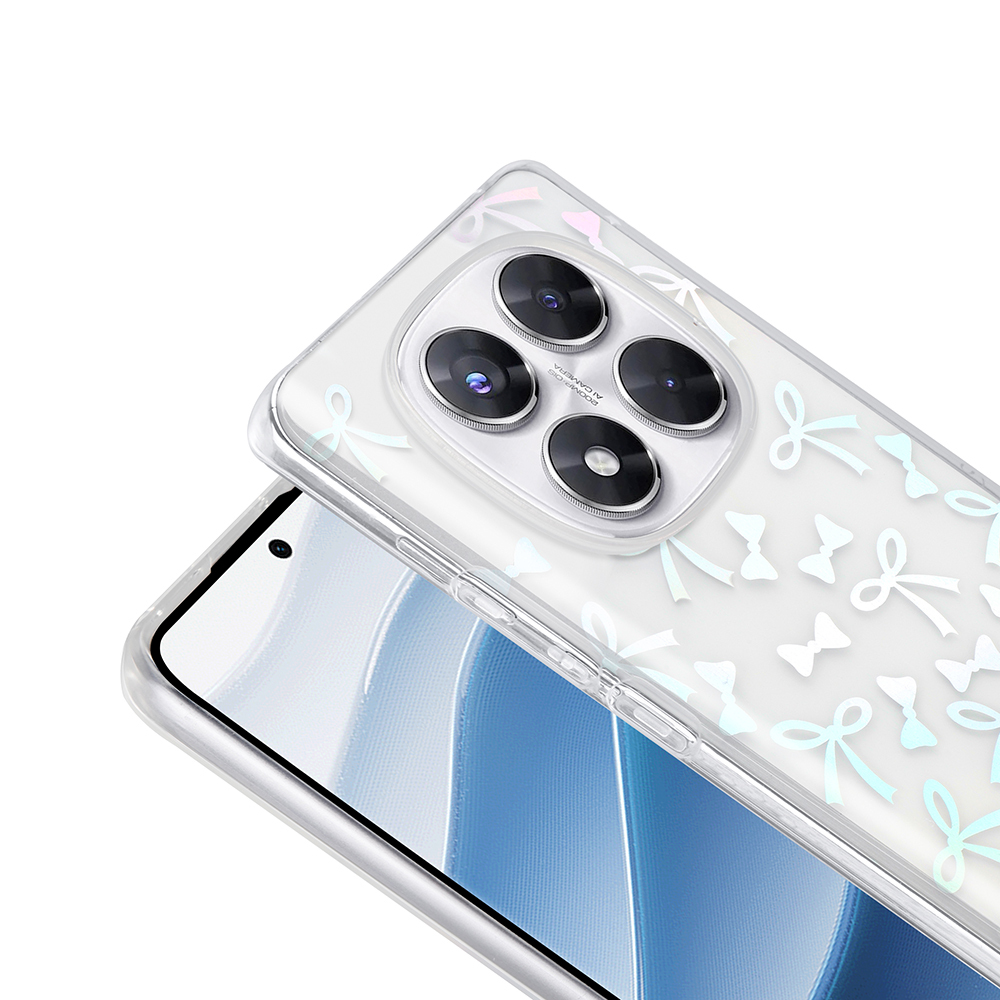 Mavi gradyanlı bir ekran gösteren bir telefonu kaplayan, fiyonk desenli şeffaf telefon kılıfı. Kılıfta dört kamera merceği var.