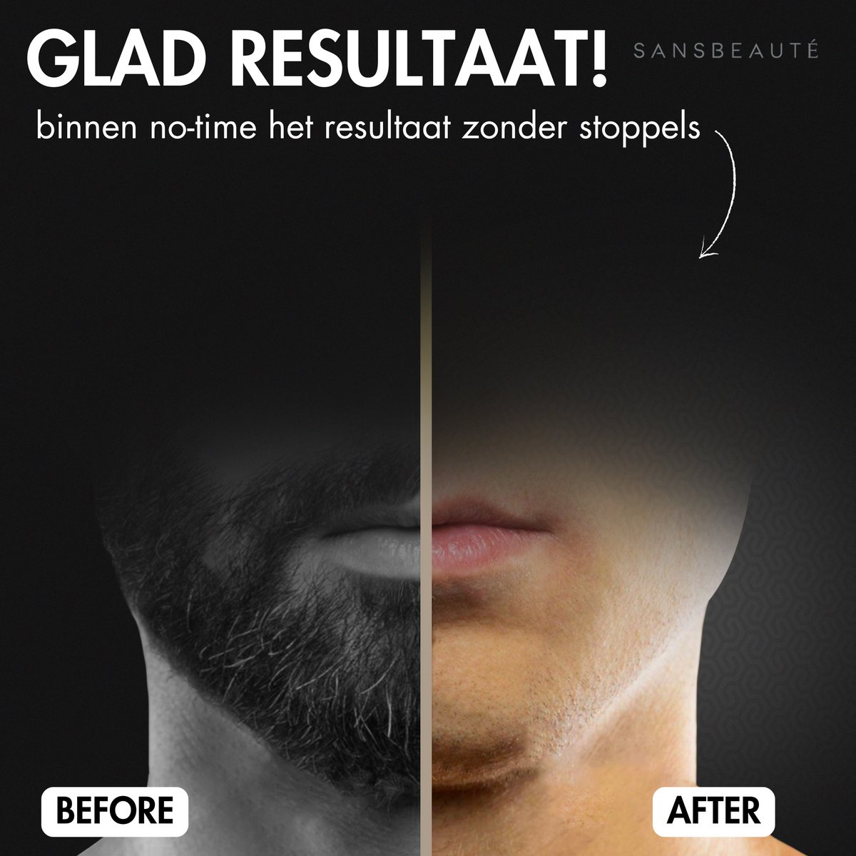 La imagen muestra la cara de un hombre antes y después. El lado izquierdo tiene una barba oscura. El lado derecho tiene piel lisa.