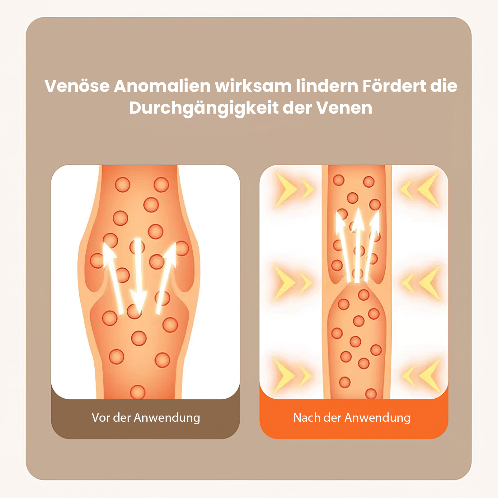 Diagramm, das eine Vene vor und nach der Behandlung zeigt. Pfeile zeigen verbesserten Blutfluss. Text auf Deutsch.