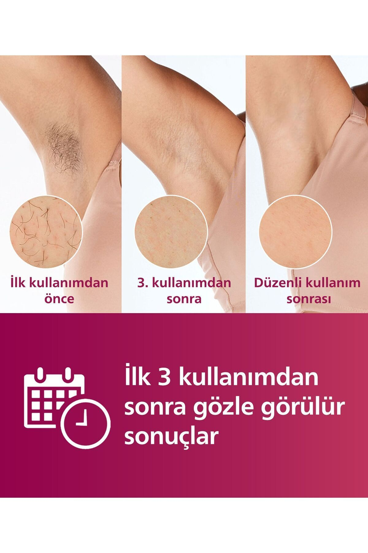 Görselde koltuk altları epilasyon öncesi ve sonrası gösteriliyor. 3 kullanımdan sonra ve düzenli kullanım sonuçları gösteriliyor.