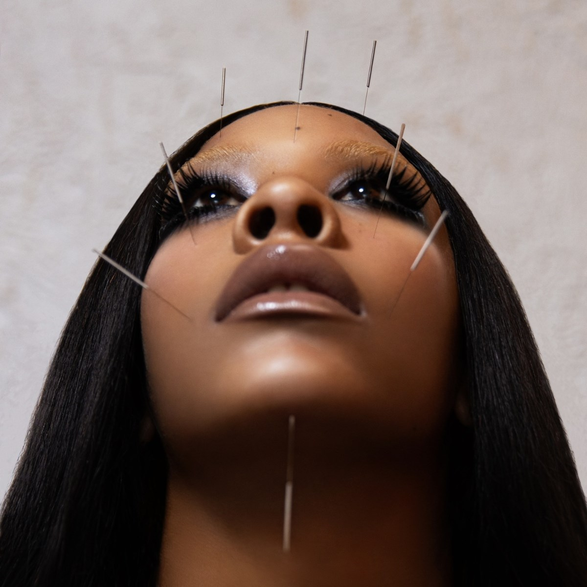 Primo piano del volto di una donna con aghi di agopuntura inseriti. Ha capelli scuri, lunghe ciglia e sta guardando in alto.