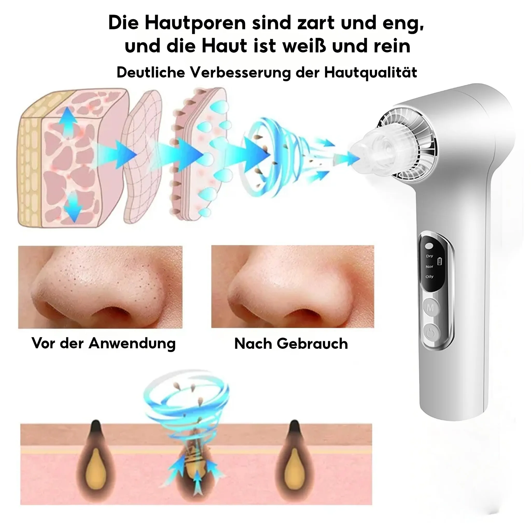 Das Bild zeigt ein Hautpflegegerät und seine Wirkung. Diagramme veranschaulichen die Porenreinigung. Vorher/Nachher-Nasenbilder zeigen eine Verbesserung.
