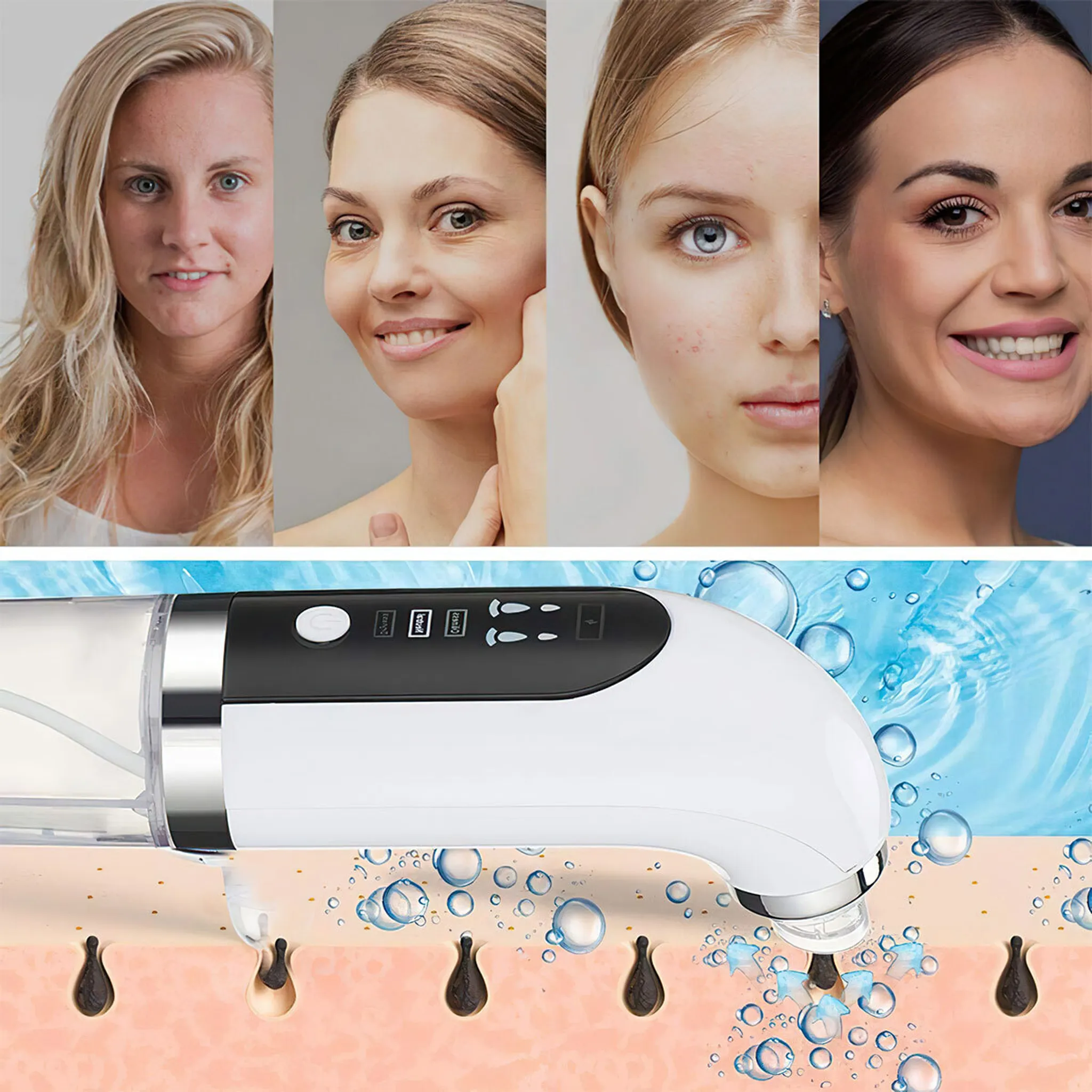 Das Bild zeigt Frauen und ein Hautpflegegerät. Gerät entfernt Mitesser auf einem Hautdiagramm. Blasen und Wasser sind vorhanden.