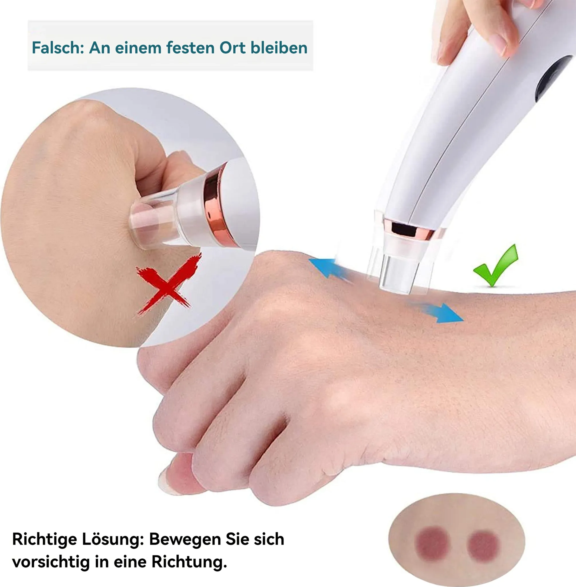 Ein Hautporen-Vakuum auf einer Hand. Falsche Methode zeigt ein rotes X. Richtige Methode zeigt ein grünes Häkchen.