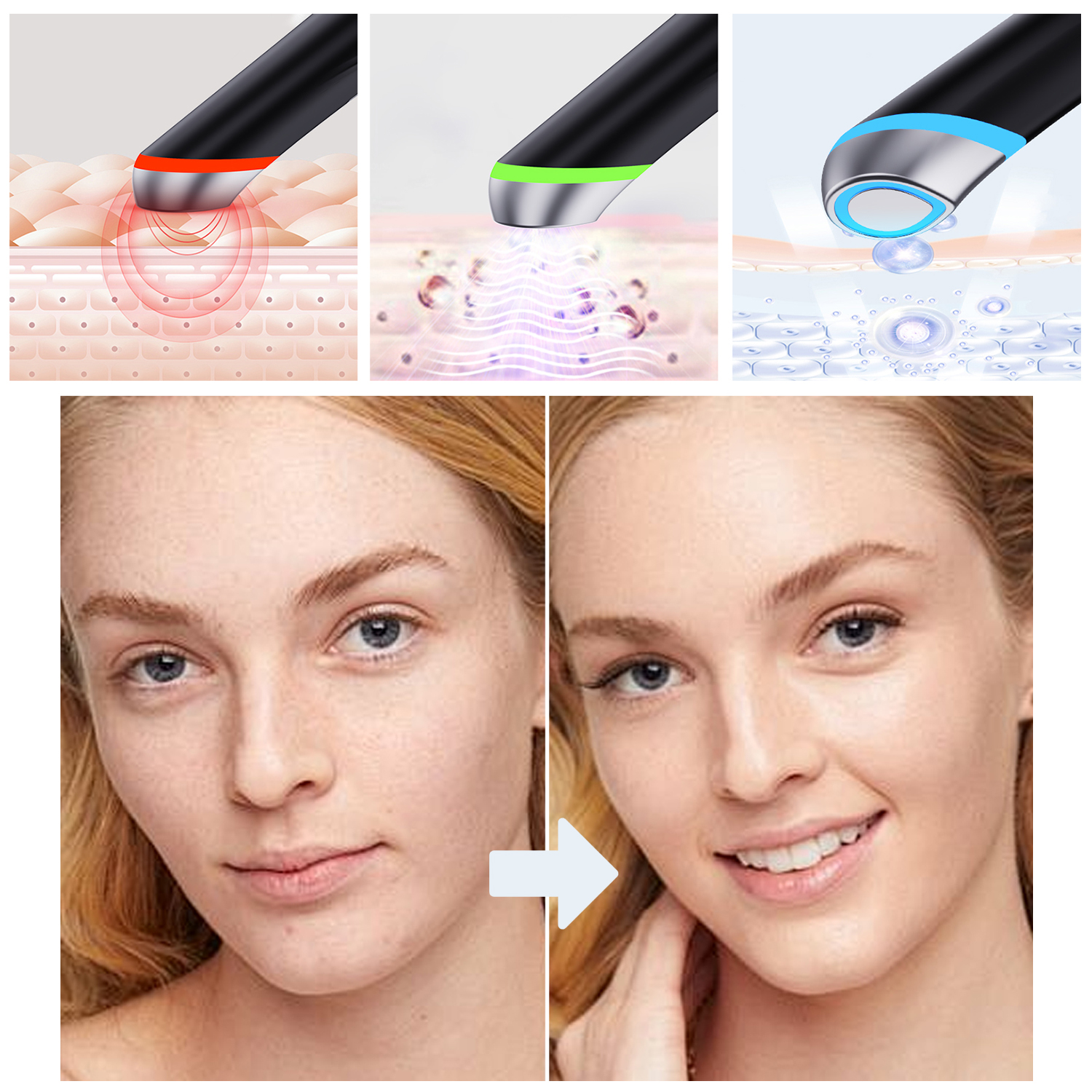 La imagen muestra un dispositivo de tratamiento de la piel. Imágenes del antes y el después del rostro de una mujer, mostrando la mejora de la piel. Primeros planos del dispositivo en uso.