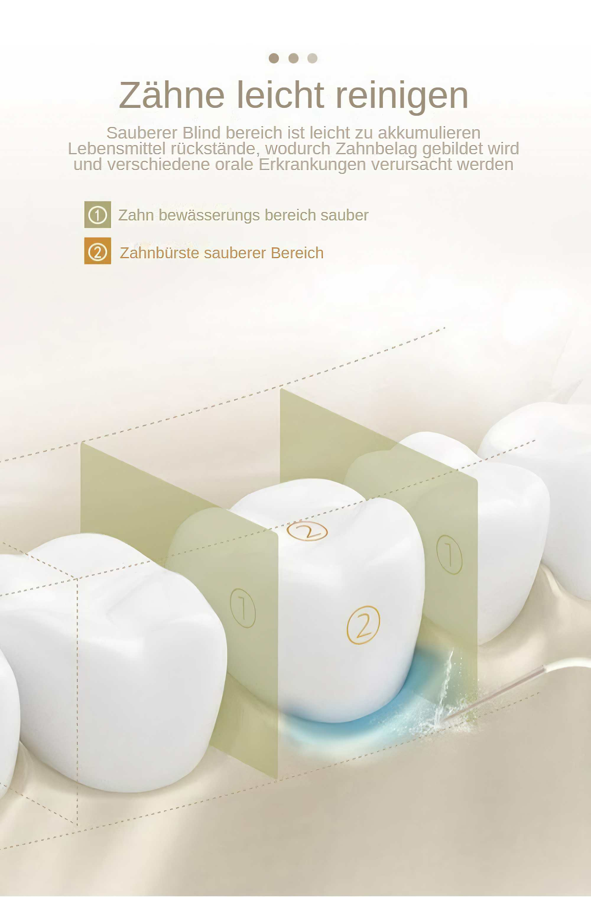 Diagramm, das den Zahnreinigungsprozess zeigt. Weiße Zähne sind mit nummerierten Abschnitten und Textbeschreibungen hervorgehoben.