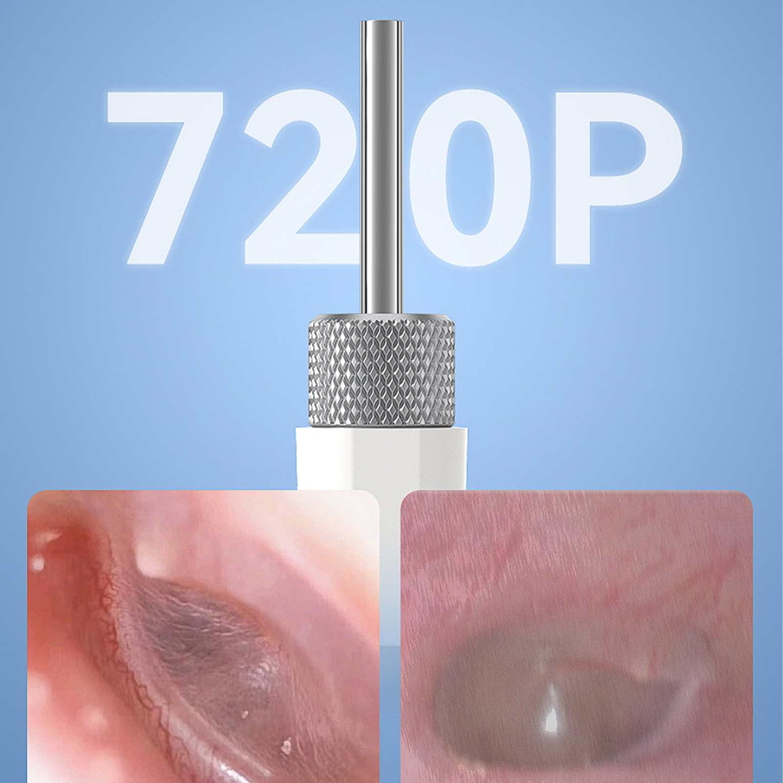 Das Bild zeigt ein Ohruntersuchungsgerät mit zwei Ansichten des Gehörgangs. Der Text "720P" ist auf blauem Hintergrund überlagert.