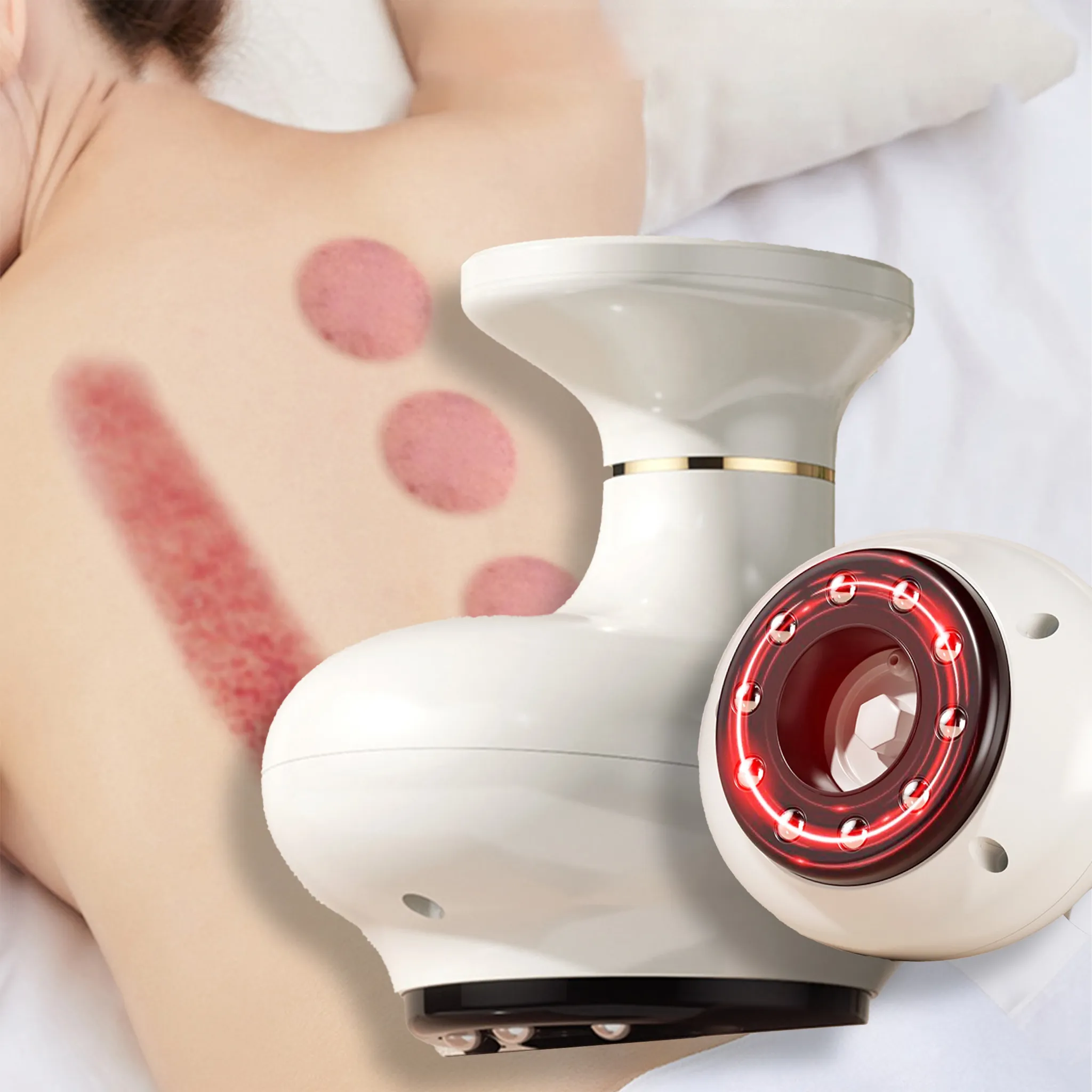 Rücken mit Schröpfmalen und ein weißes Massagegerät mit roten Lichtern.