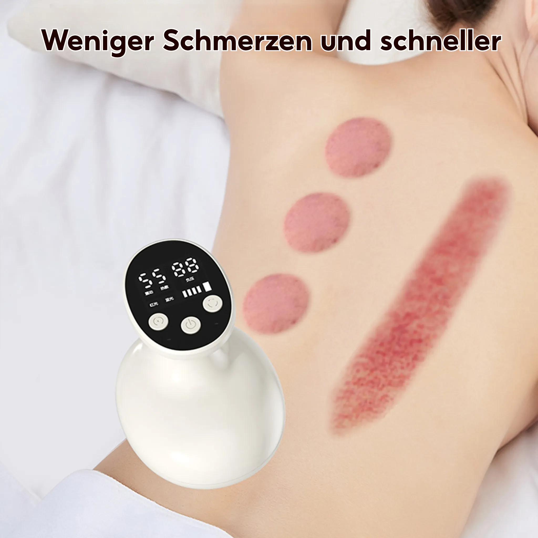Das Bild zeigt einen Rücken mit Schröpfmalen und ein weißes Gerät mit einem Bildschirm, was auf eine Schröpftherapie hindeutet.