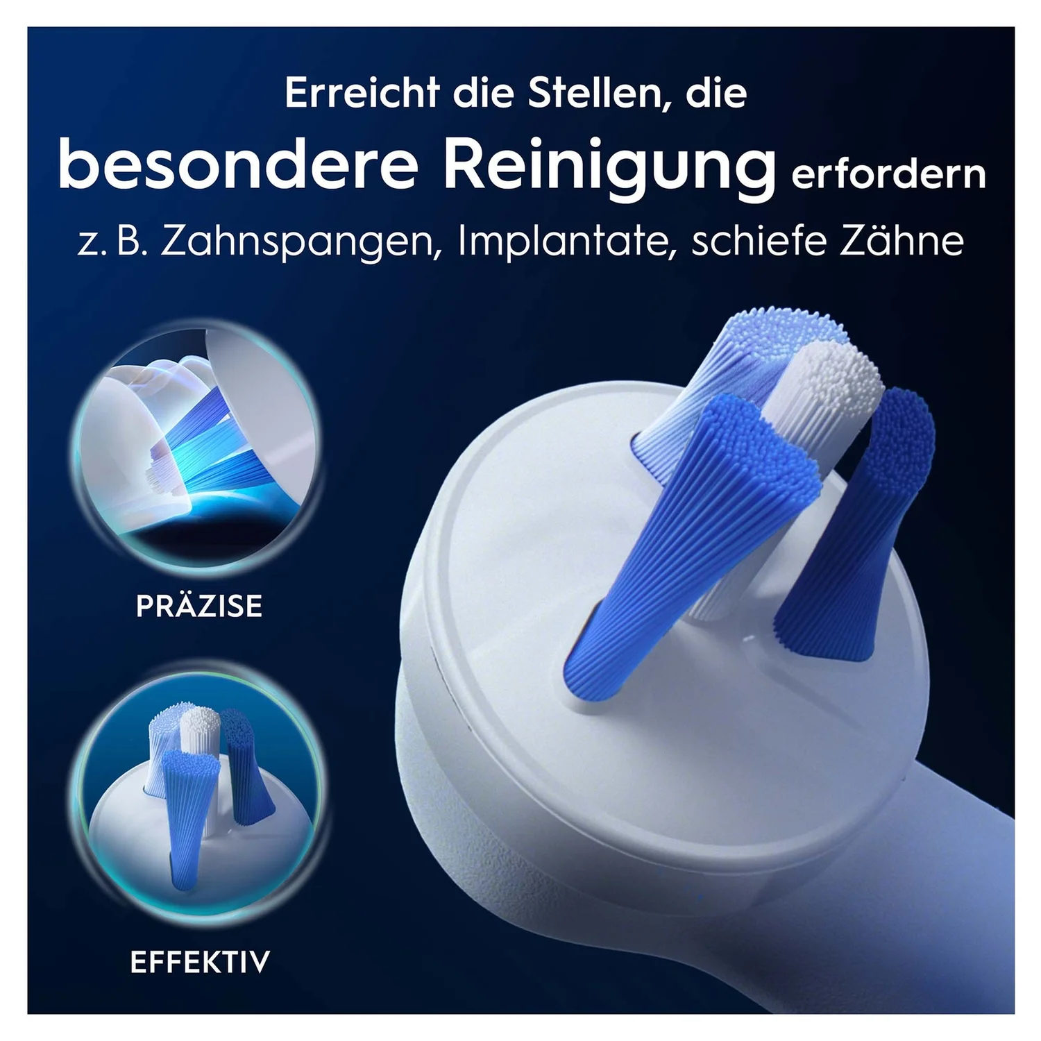 Elektrischer Zahnbürstenkopf mit blauen und weißen Borsten. Text erwähnt präzise Reinigung für Zahnspangen und Implantate.