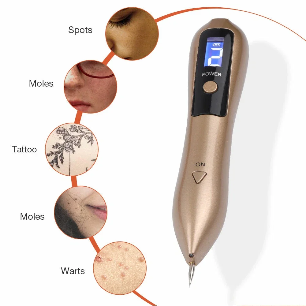 Ein goldener Stift zur Entfernung von Hautanhängseln mit blauem Display. Kreise zeigen Hauterkrankungen: Flecken, Muttermale, Tätowierung, weitere Muttermale und Warzen.