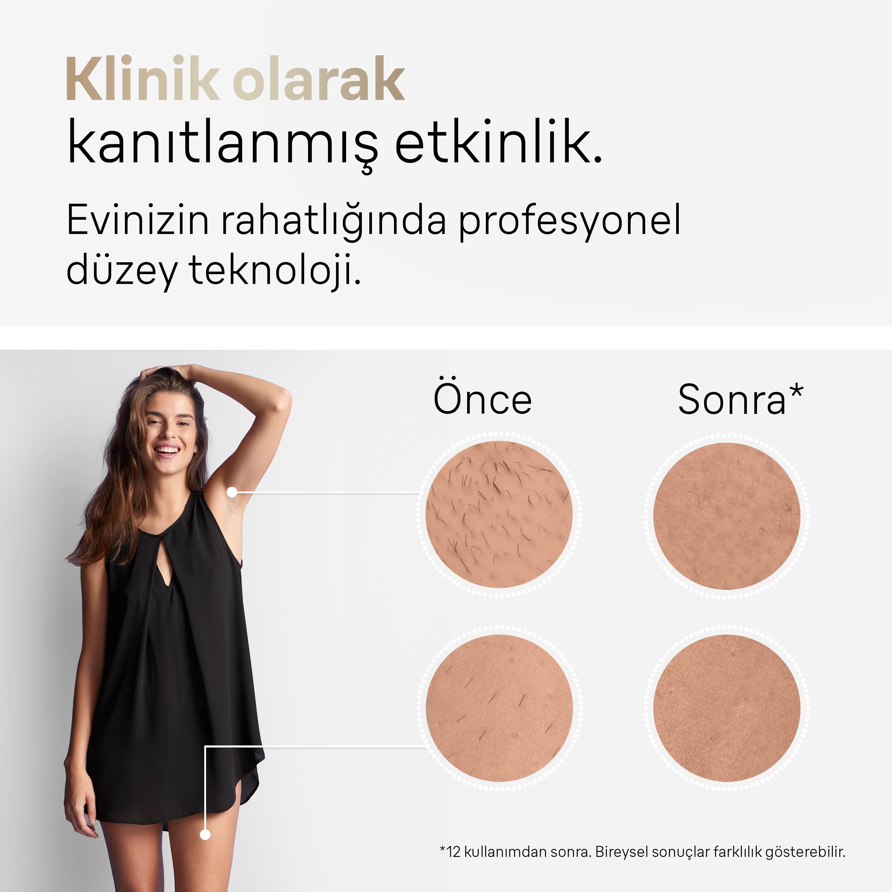 Kobieta w czarnej sukience z podniesioną ręką. Zbliżenia skóry przed/po. Tekst: Skuteczność potwierdzona klinicznie.